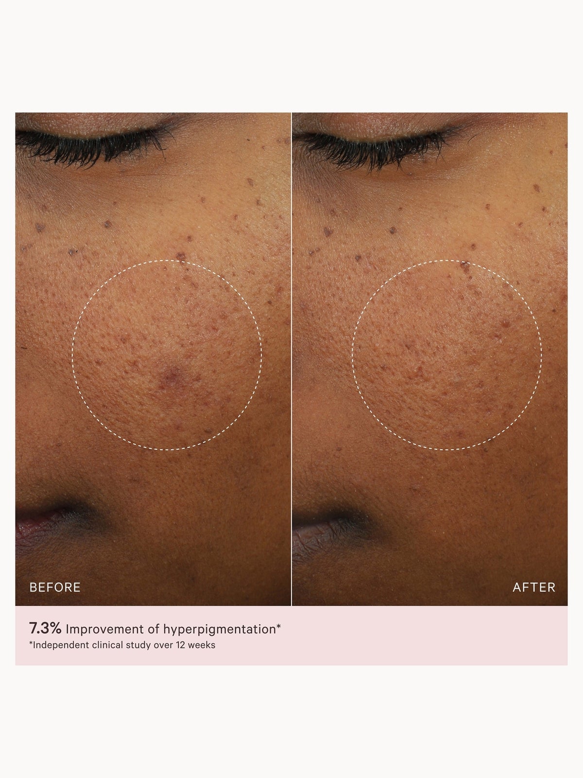 MZ Skin Micro-Peeling Glow Essence 100ml 4