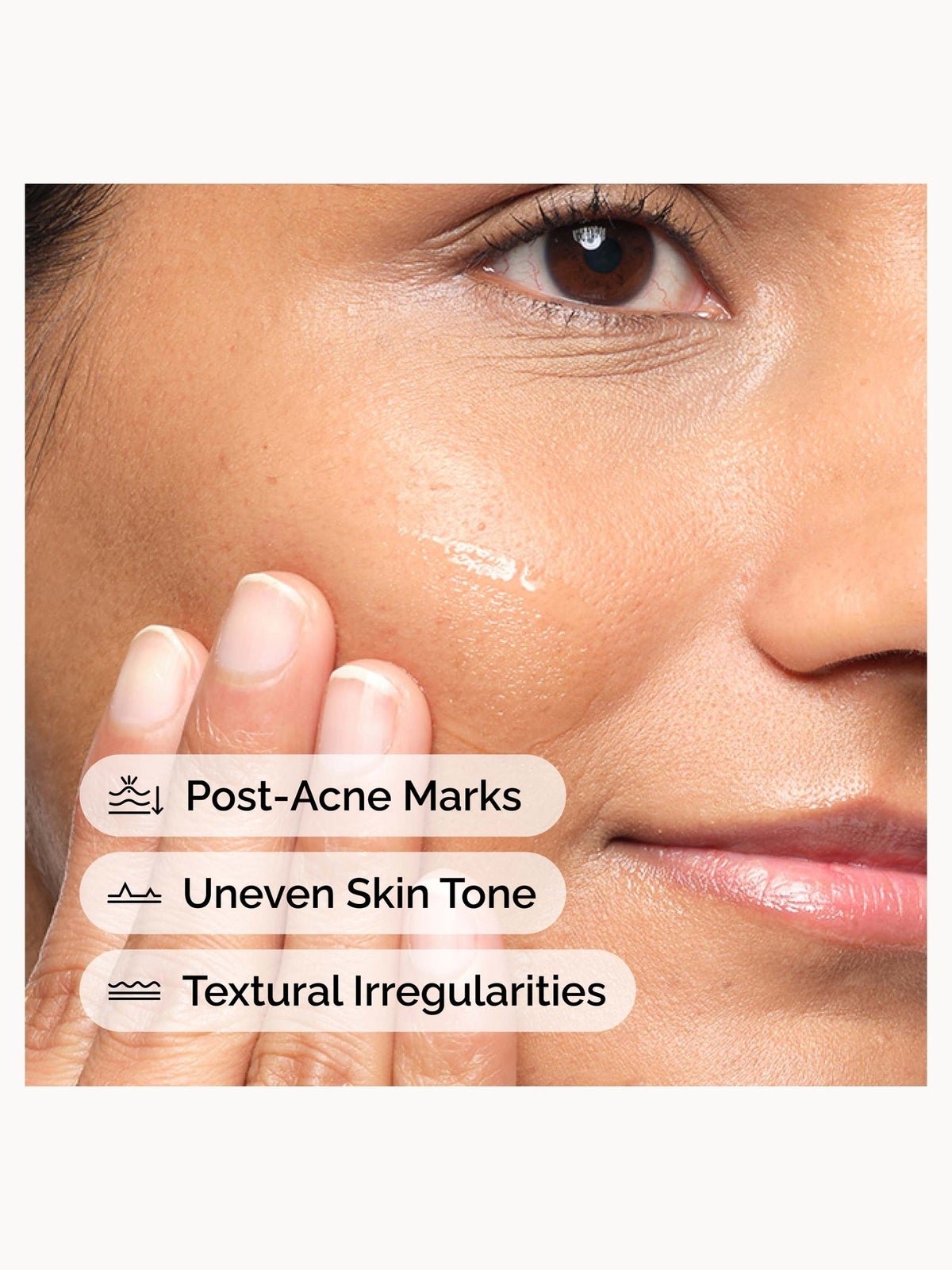 The Ordinary Aloe 2% + NAG 2% Solution Serum 30ml 3