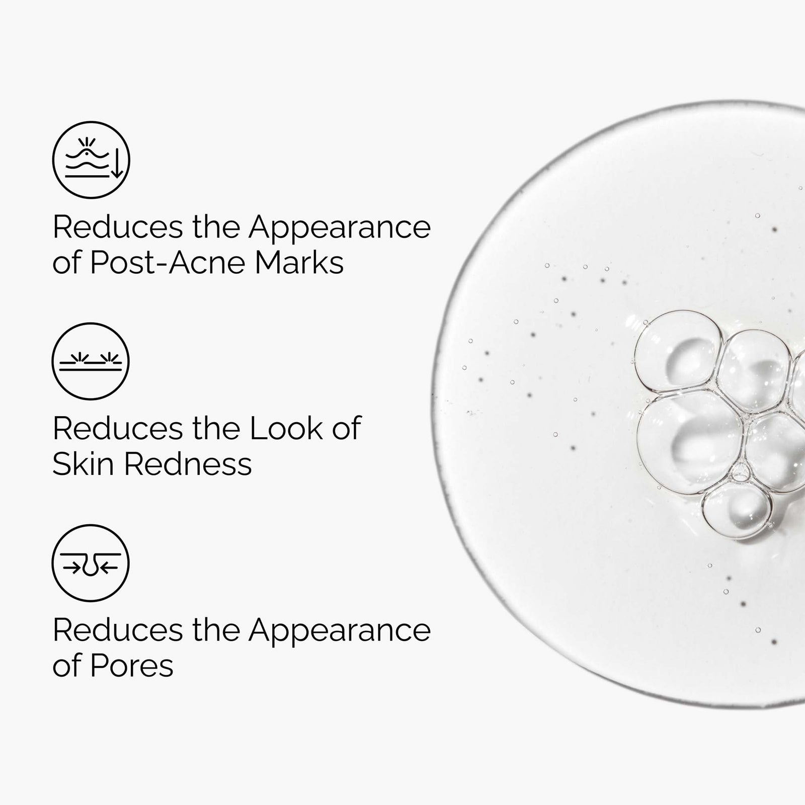 THE Ordinary Solution à l'Aloe 2% + NAG 2%