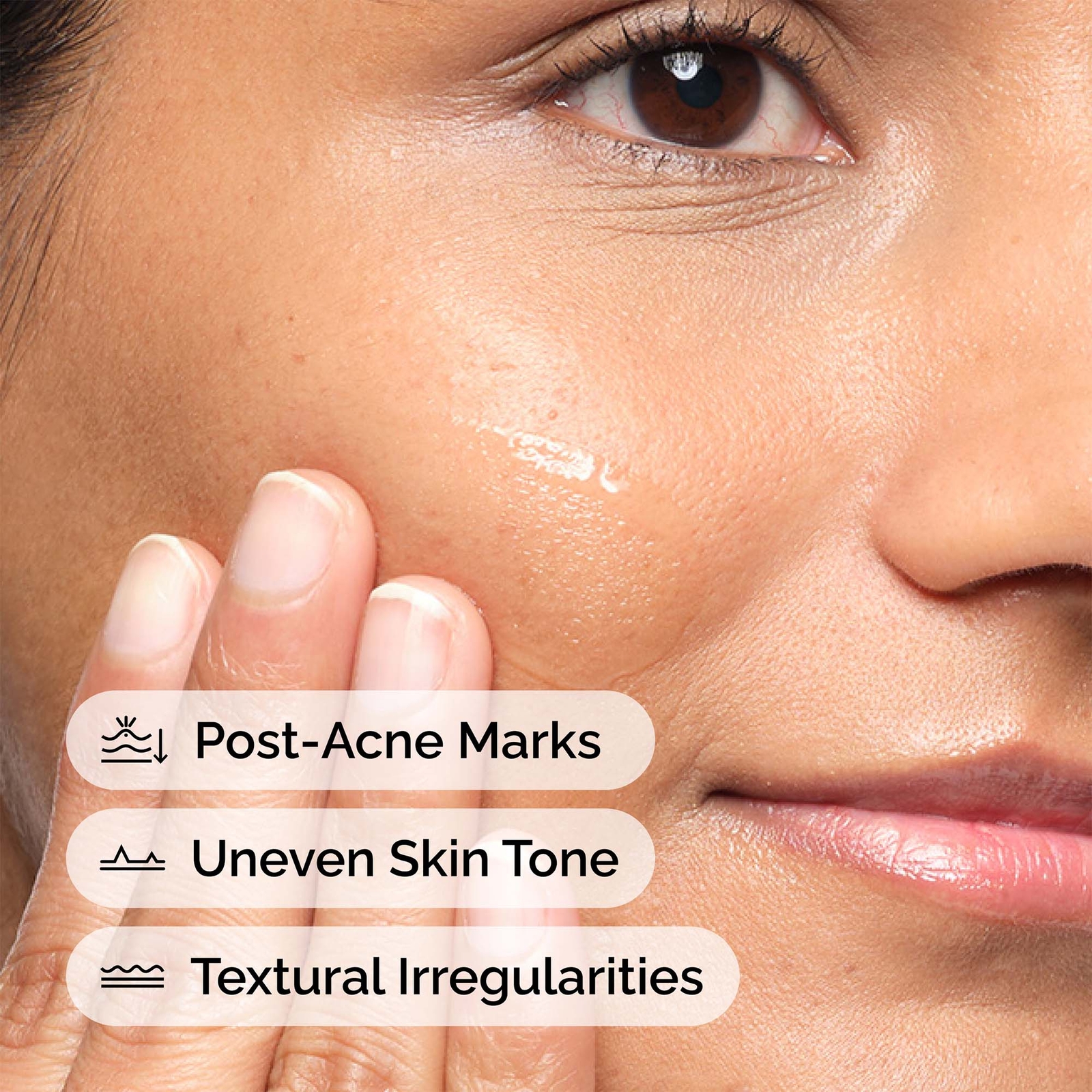 Thumbnail - The Ordinary Aloe 2% + NAG 2% Solution Serum 30 ml