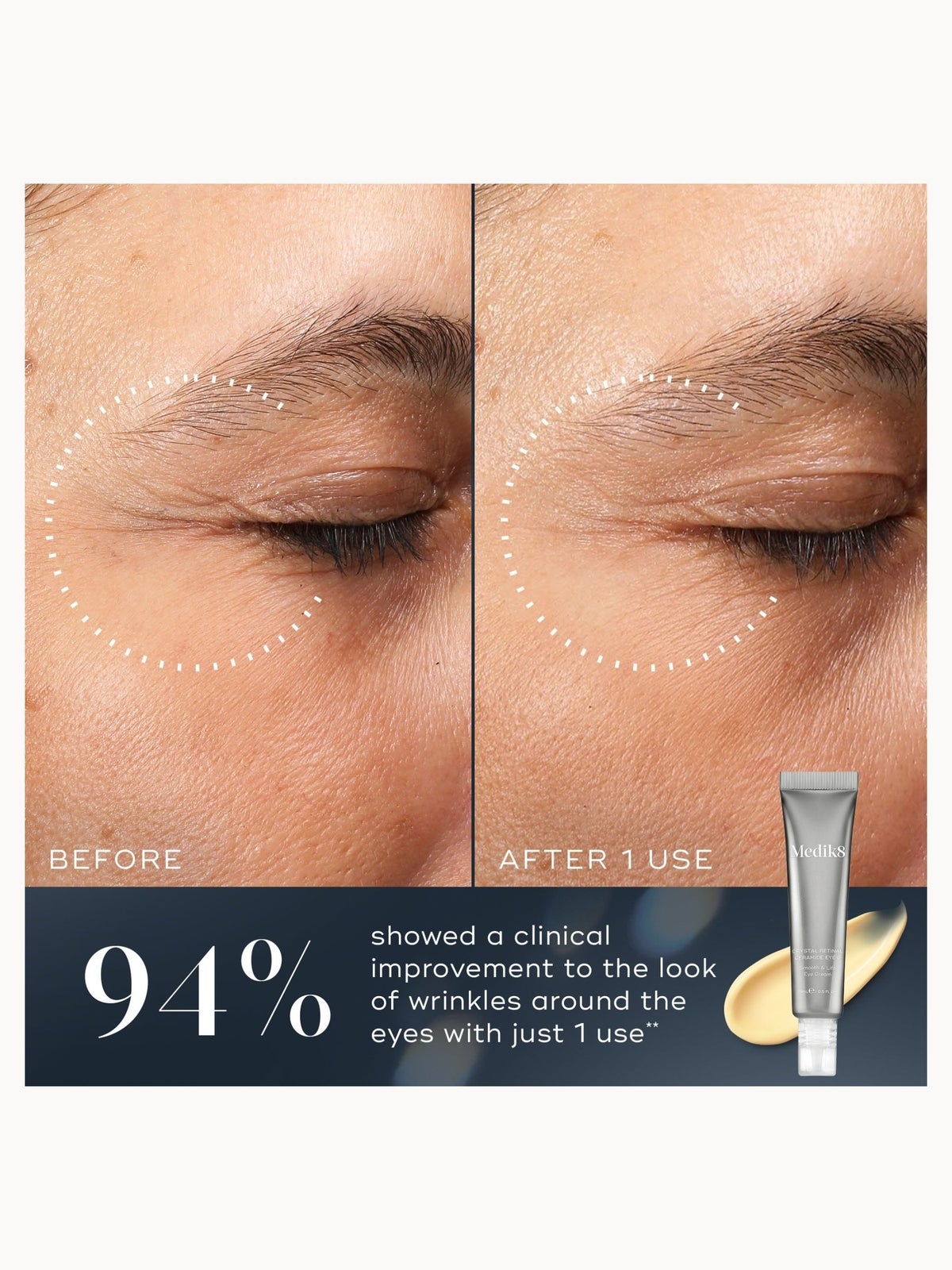 Medik8 Crystal Retinal Ceramide Eye 3 15ml 3
