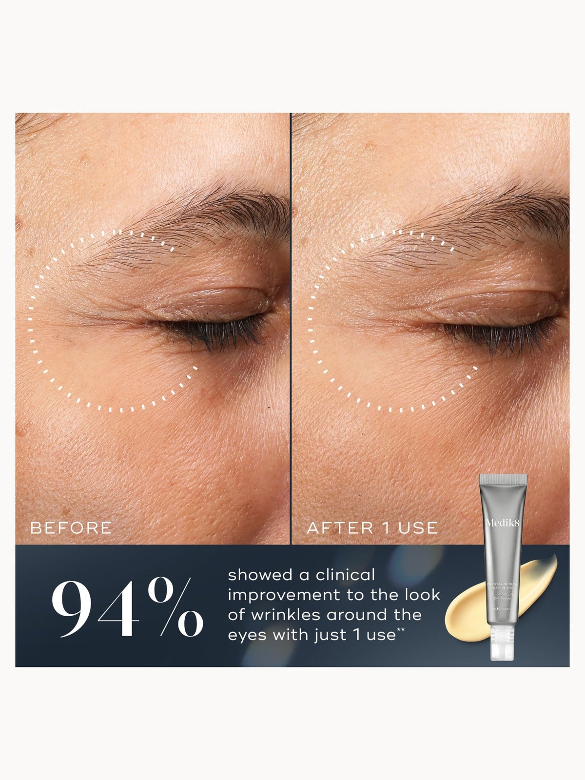 Medik8 Crystal Retinal Ceramide Eye 10 15ml, photo 3