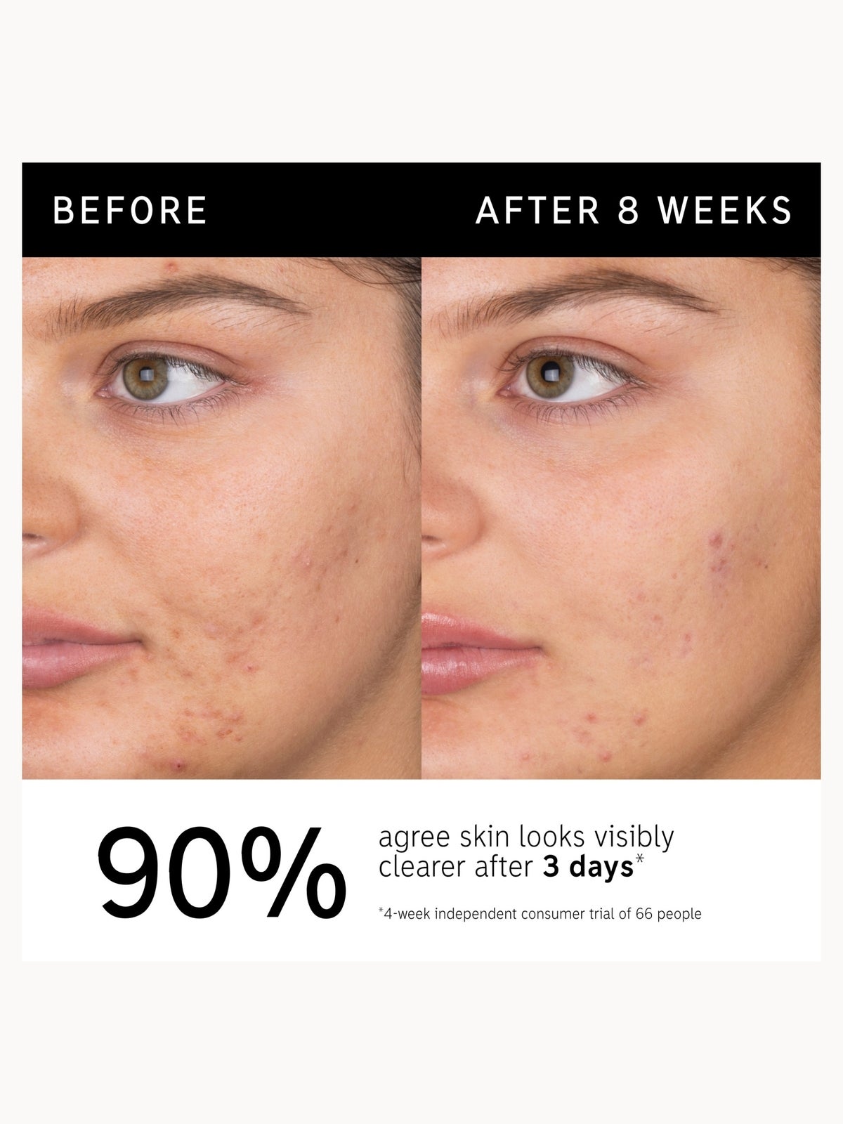 The INKEY List Salicylic Acid Cleanser 150ml 2