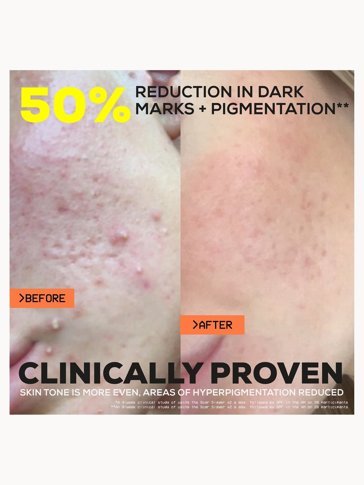 Glow Hub The Scar Slayer Facial Serum 30ml 4