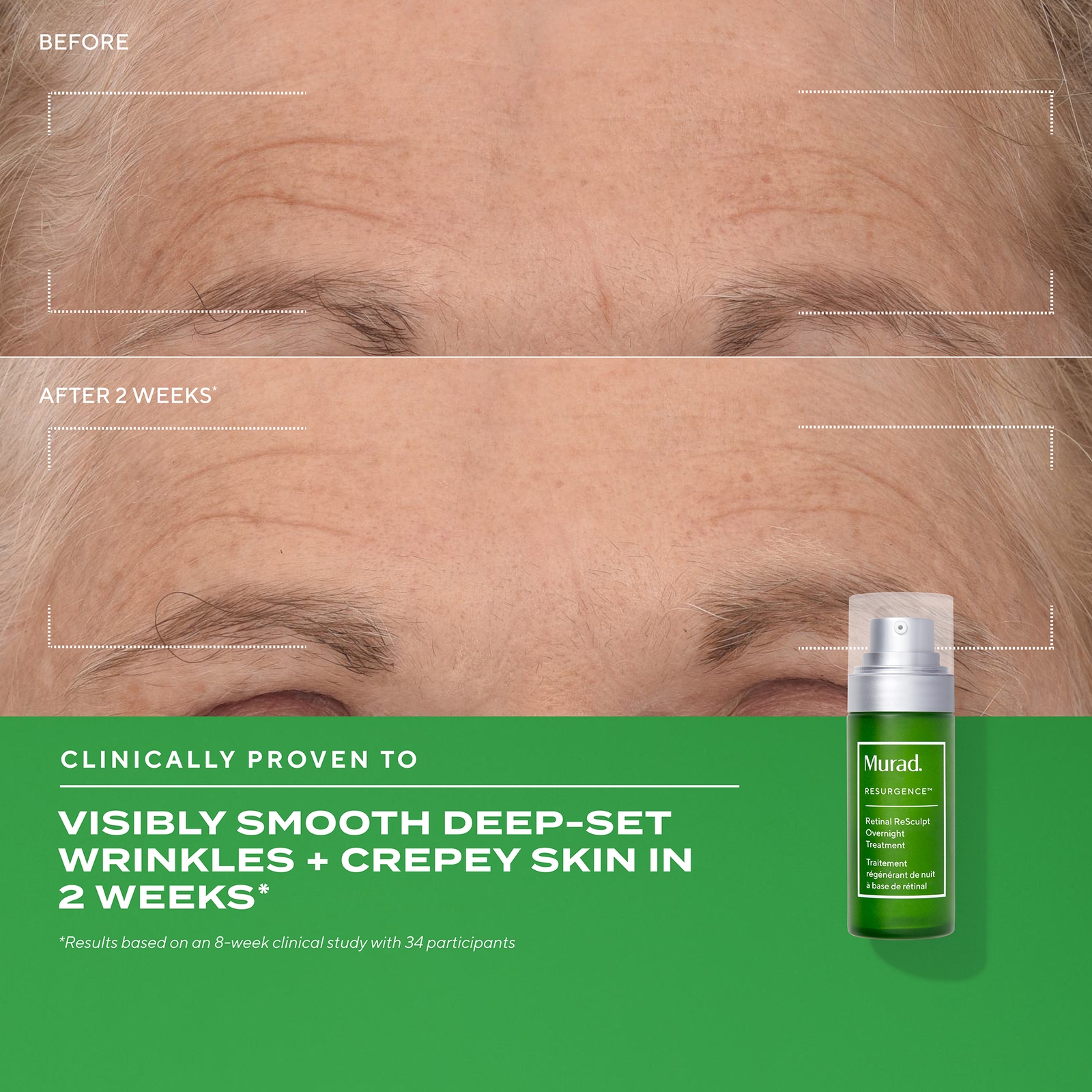 Thumbnail - Murad Retinal ReSculpt Overnight Treatment 30ml