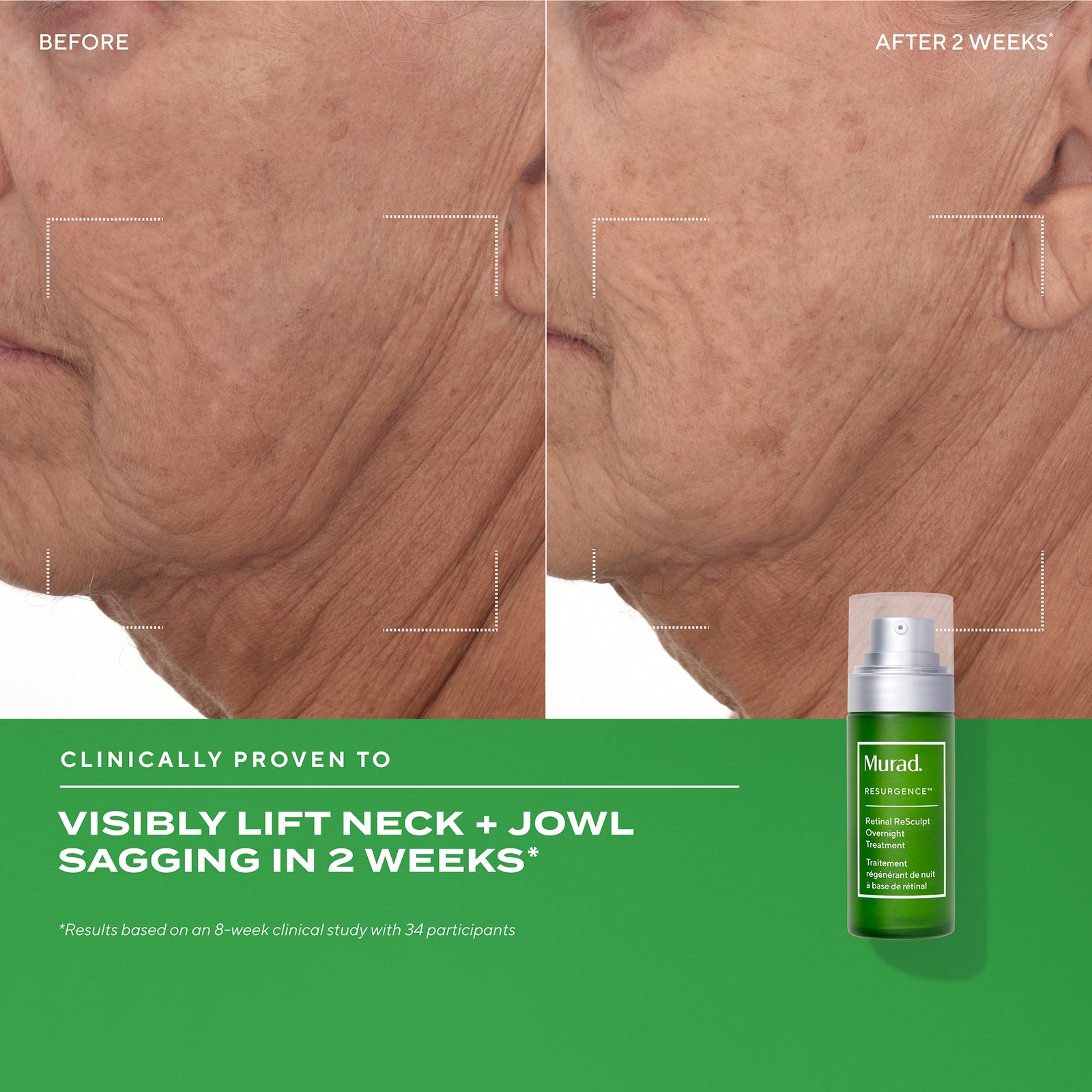 Thumbnail - Murad Retinal ReSculpt Overnight Treatment 30ml