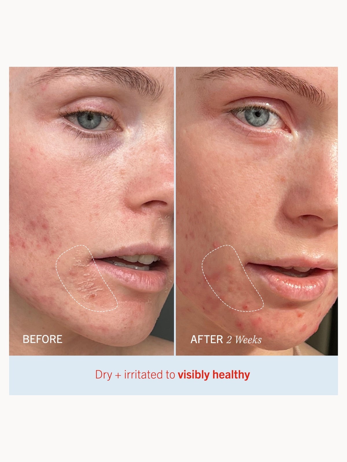 First Aid Beauty Ultra Repair Cream 226g 4