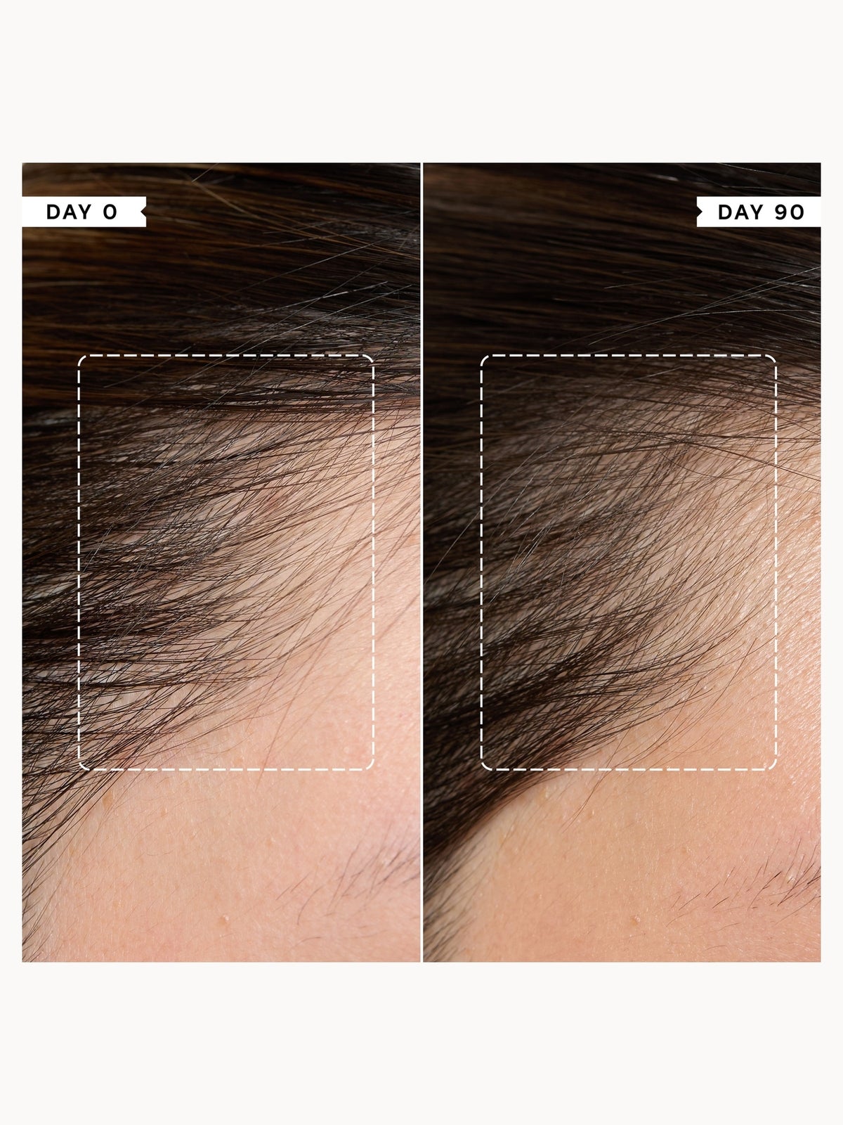 Philip Kingsley Density Hair and Scalp Preserving Collection (Worth £80) 2
