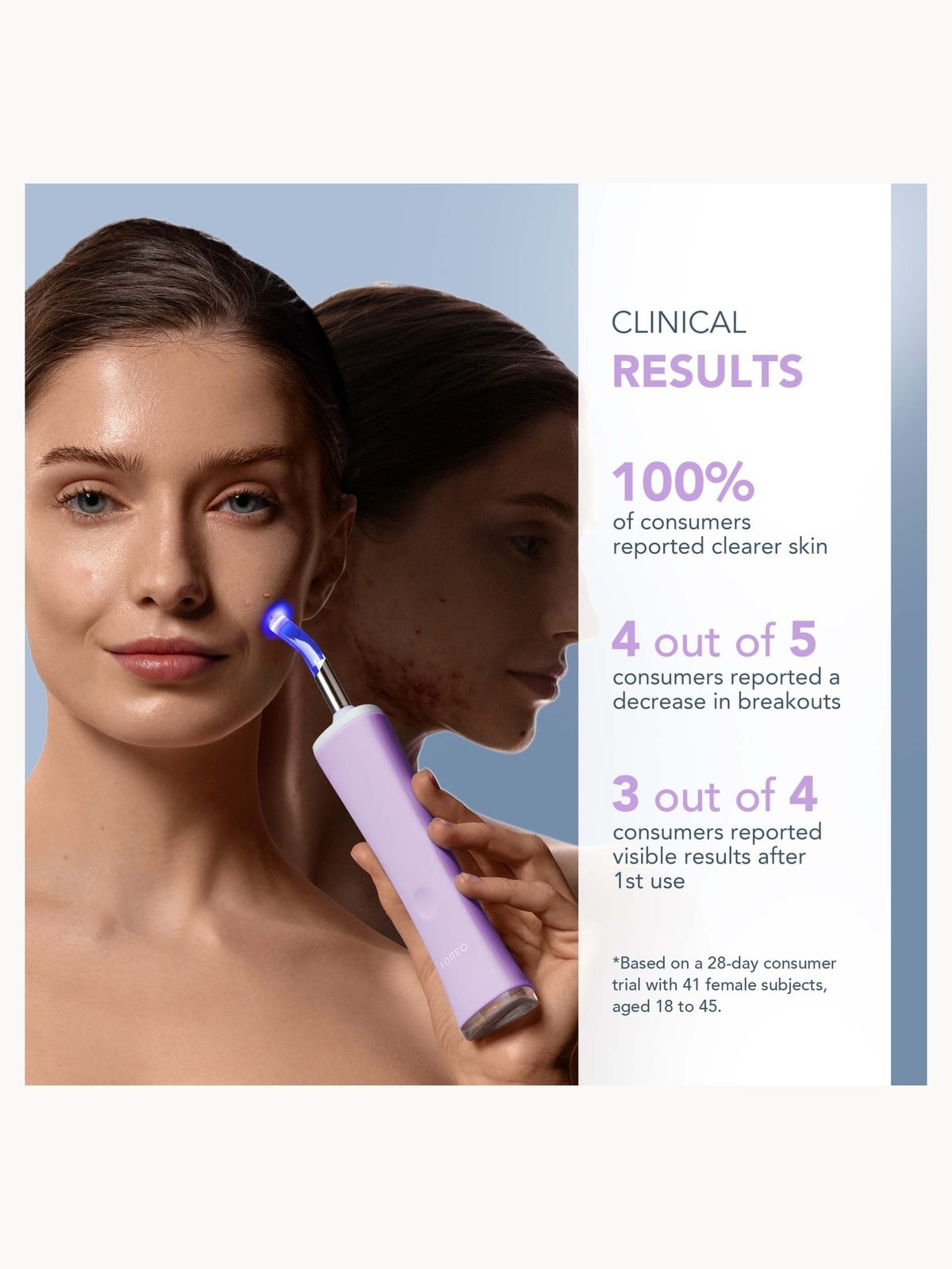 FOREO ESPADA 2 plus LED Device - Lavender 4