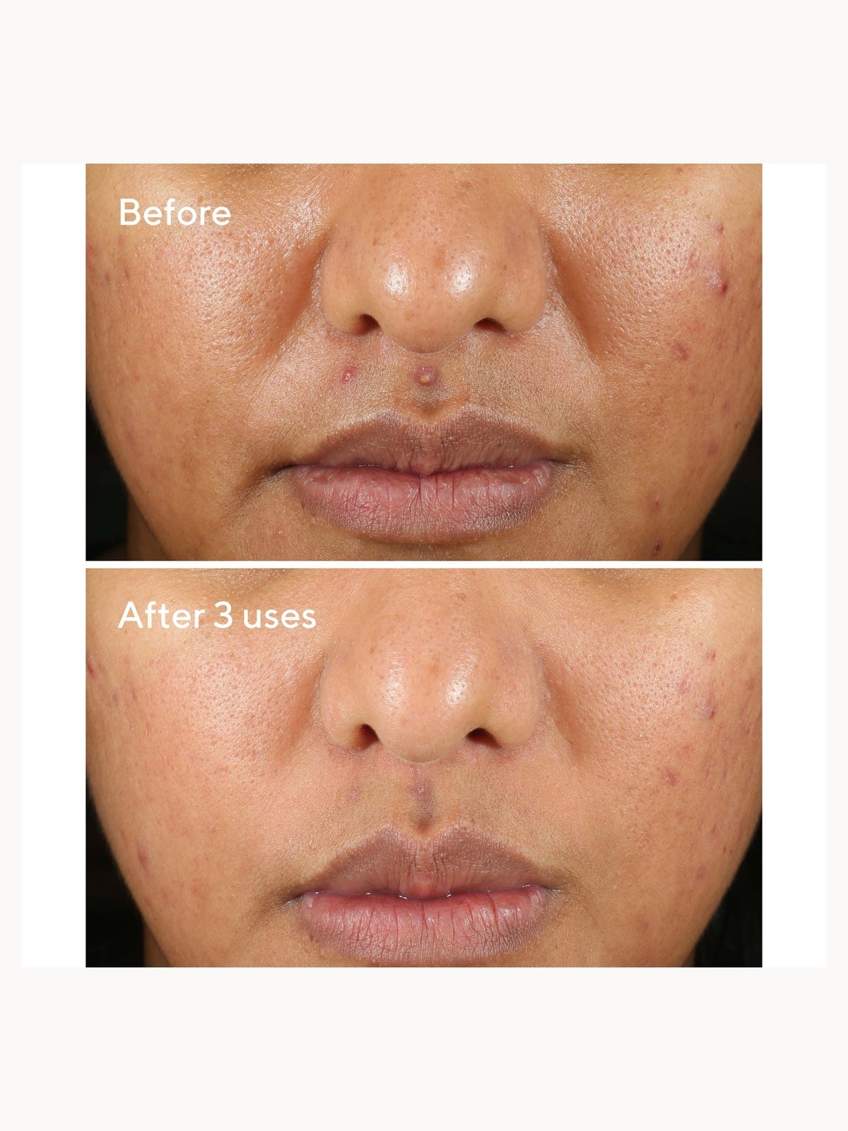 Murad Rapid Relief Sulfur Mask 75ml 2