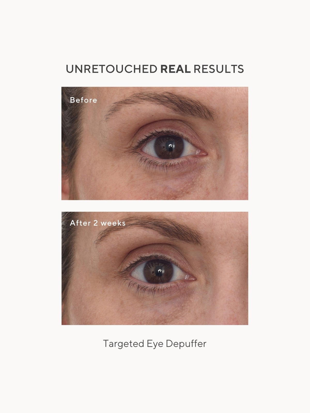 Murad Targeted Eye Depuffer 15ml 4