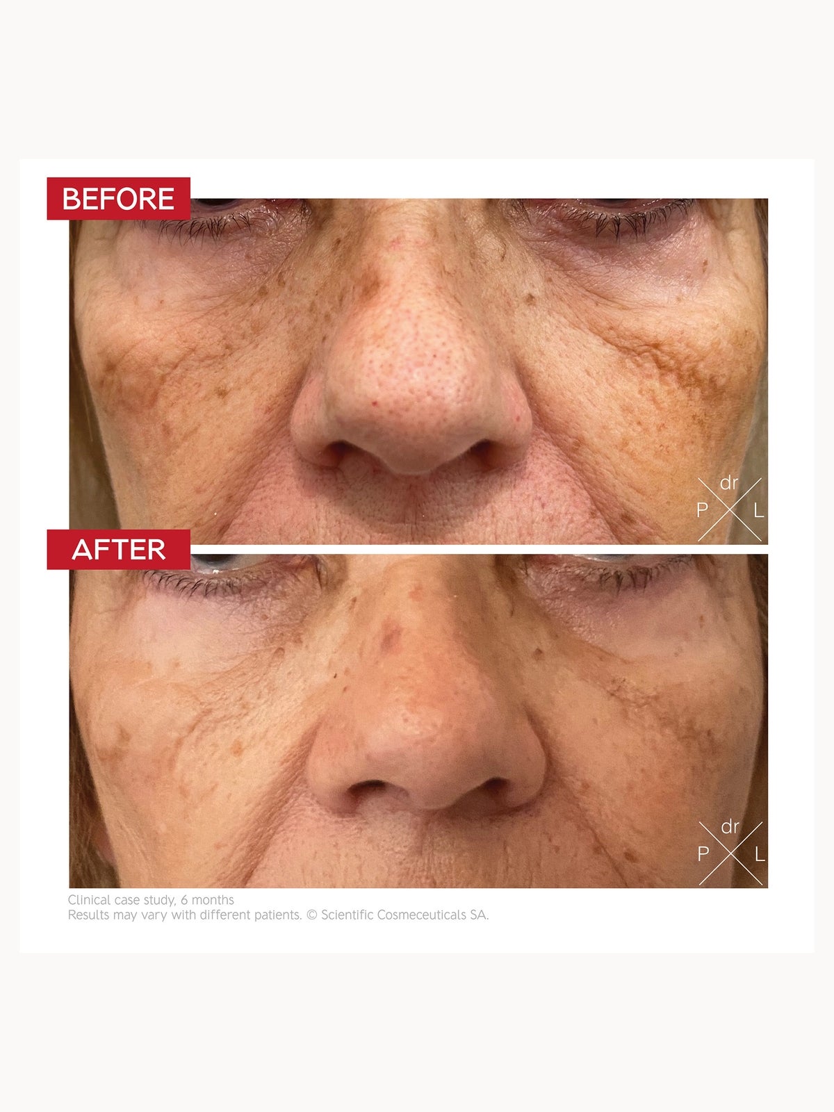 Dr. LEVY Switzerland Pigment Control Drops 30ml 3