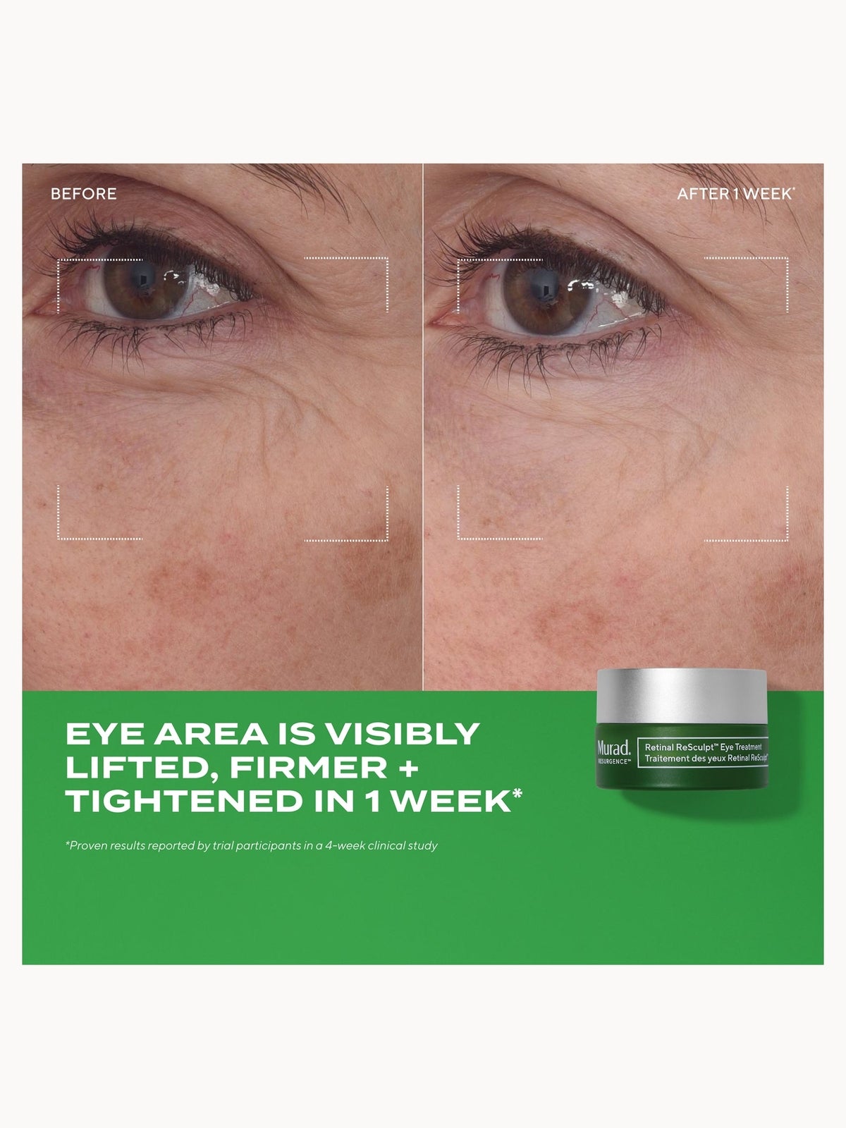 Murad Retinal ReSculpt Eye Treatment 15ml 4