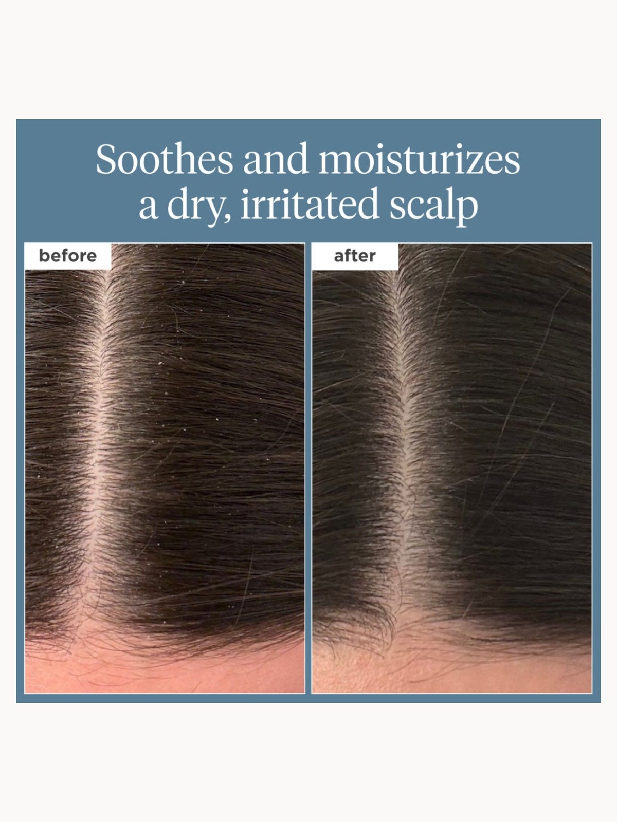 Briogeo Scalp Revival Rosemary Pre-Wash Oil for Hair and Scalp 100ml 3
