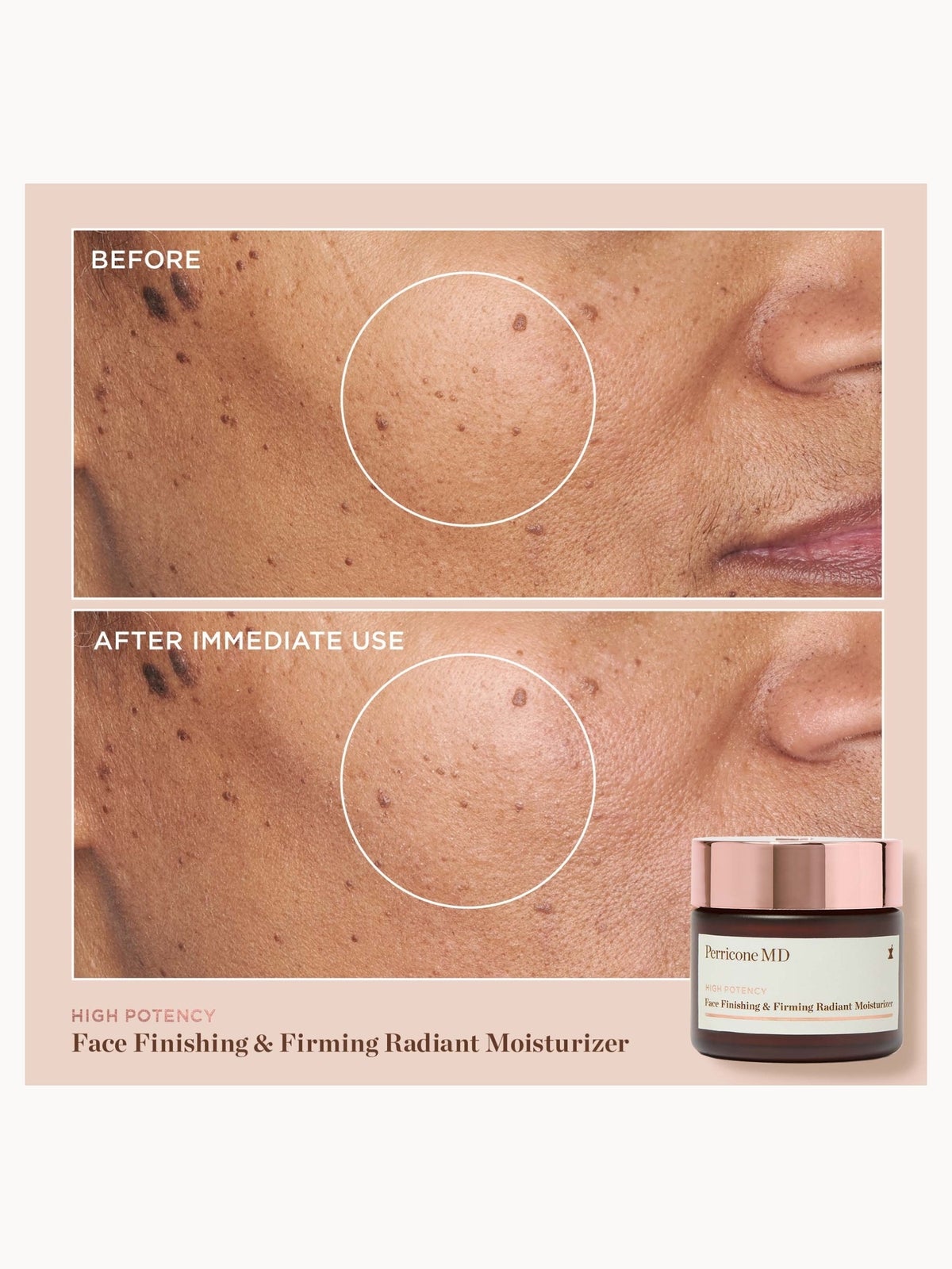Perricone MD High Potency Face Finishing & Firming Radiant Moisturiser Limited Edition 59ml 4