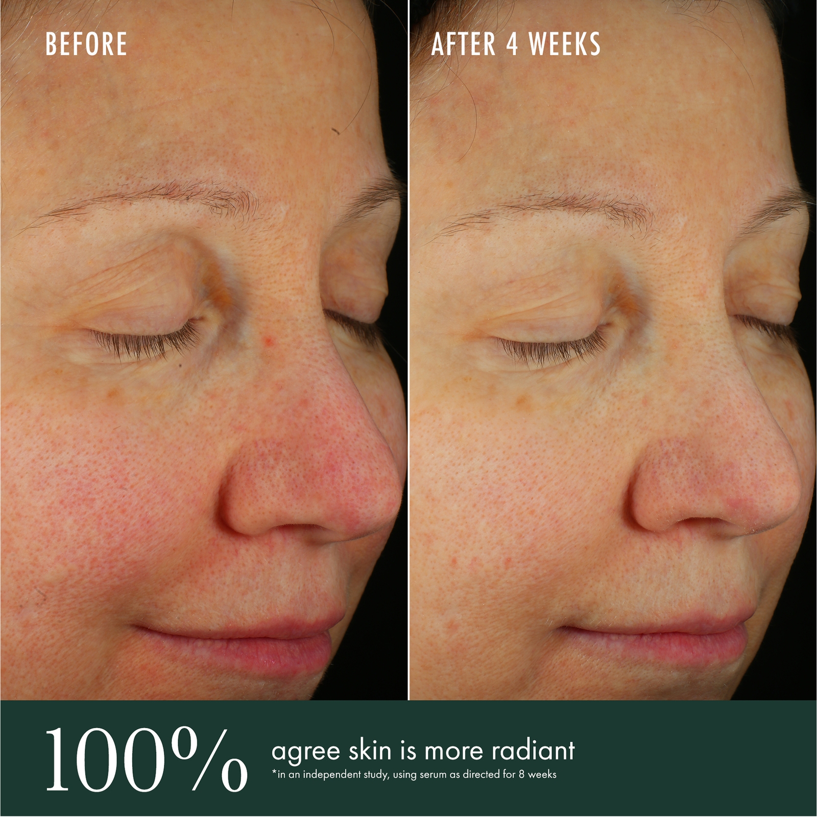 Thumbnail - RéVive Skincare Brightening Vitamin C Serum 30ml