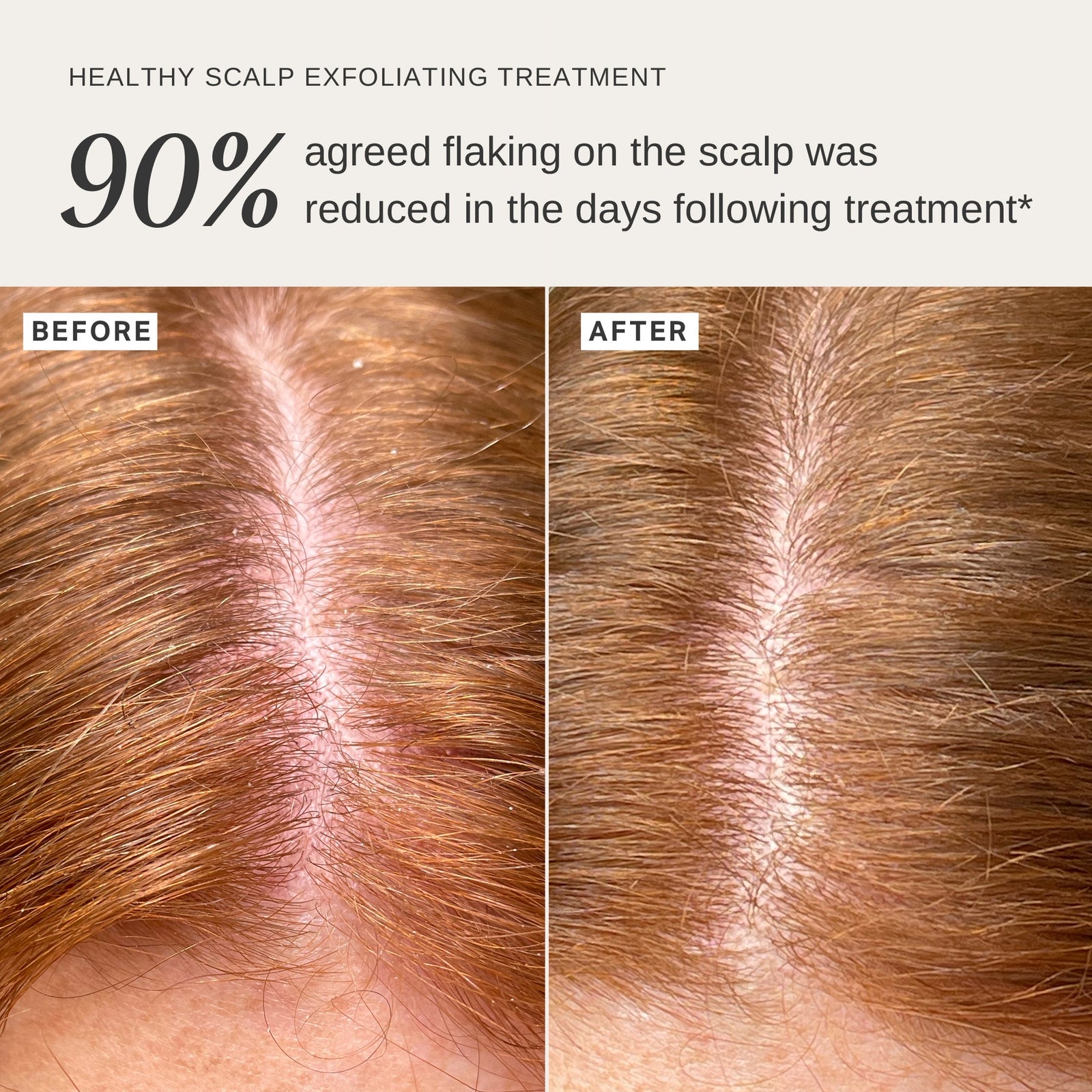 Alpha-H Healthy Scalp Exfoliating Treatment with Australian Desert Lime 100ml 2