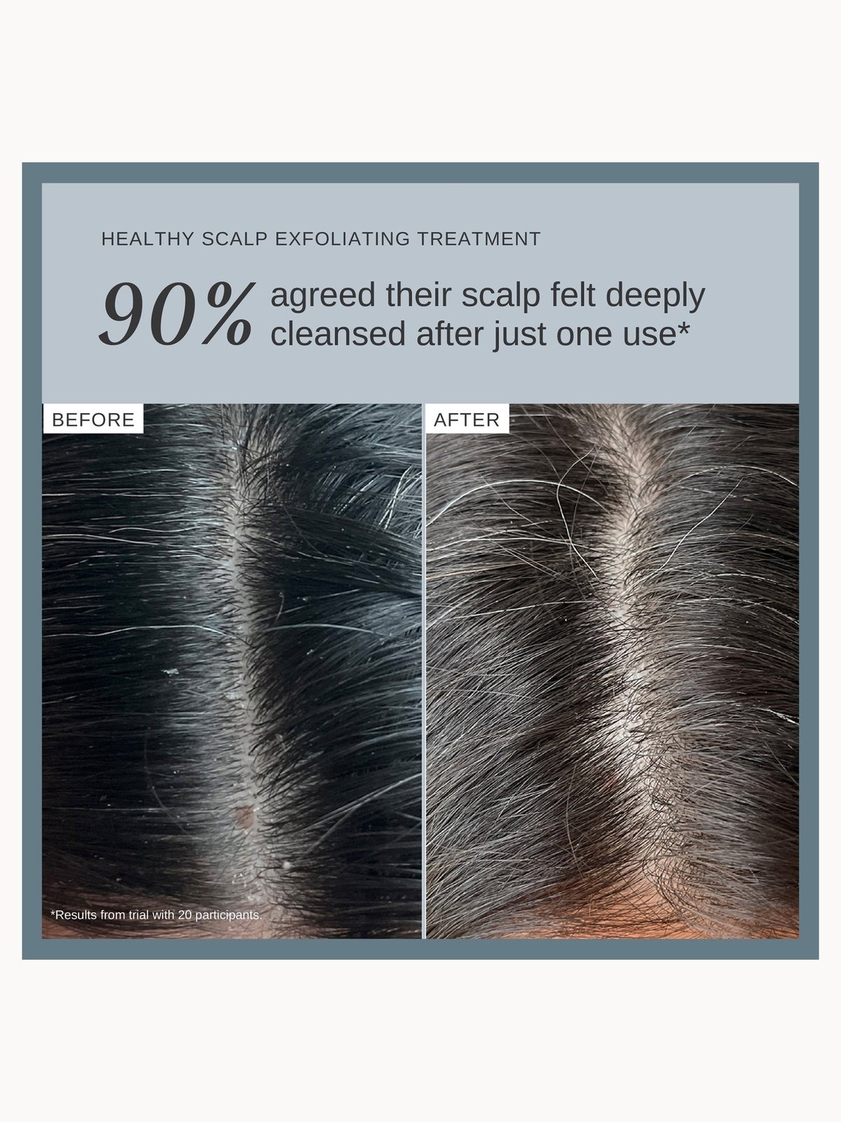 Alpha-H Healthy Scalp Exfoliating Treatment with Australian Desert Lime 100ml 4