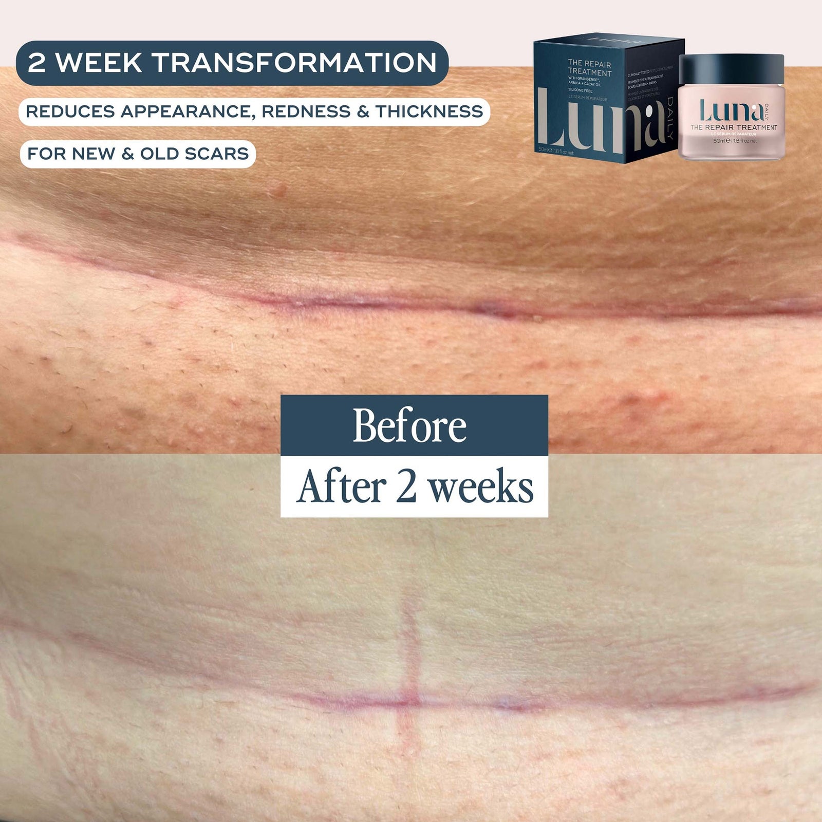 Luna Daily The Skin Repair Treatment for Scars and Hyperpigmentation 50ml 3