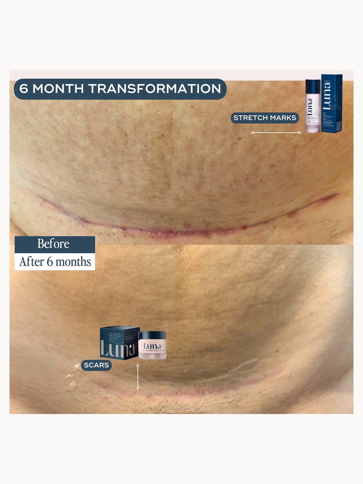 Luna Daily The Skin Repair Treatment for Scars and Hyperpigmentation 50ml 4