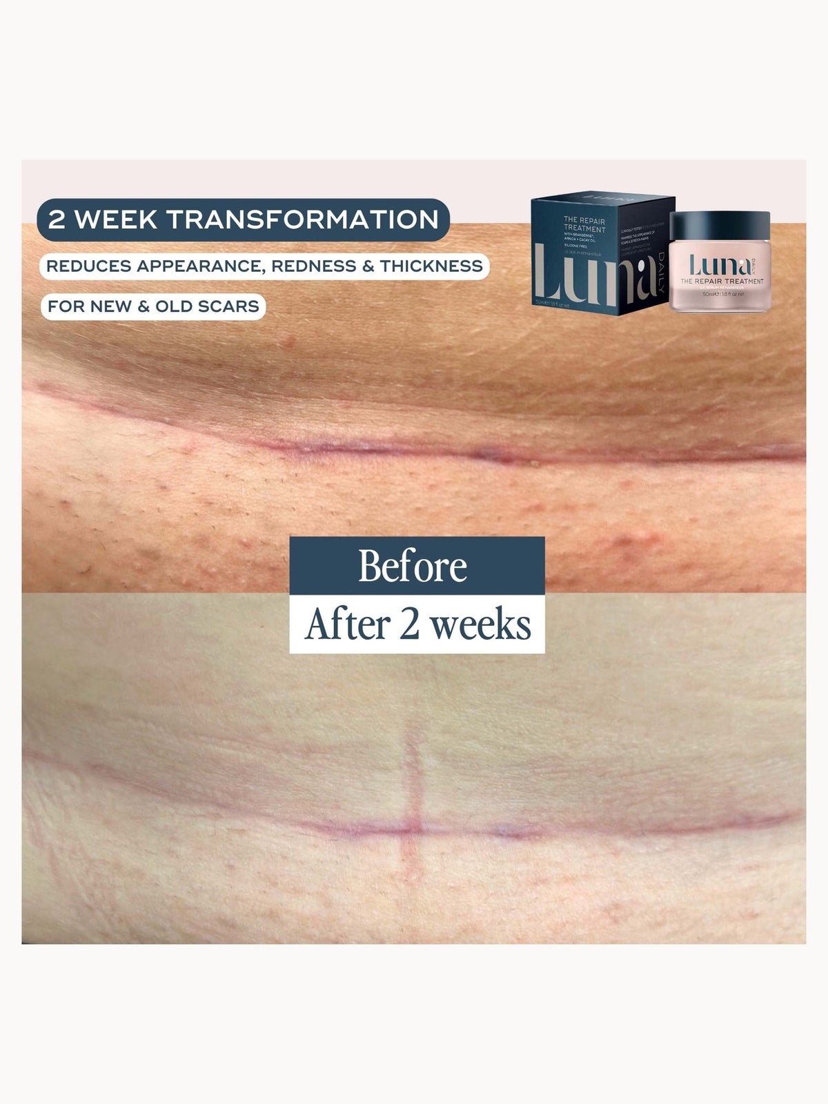 Luna Daily The Skin Repair Treatment for Scars and Hyperpigmentation 50ml 3