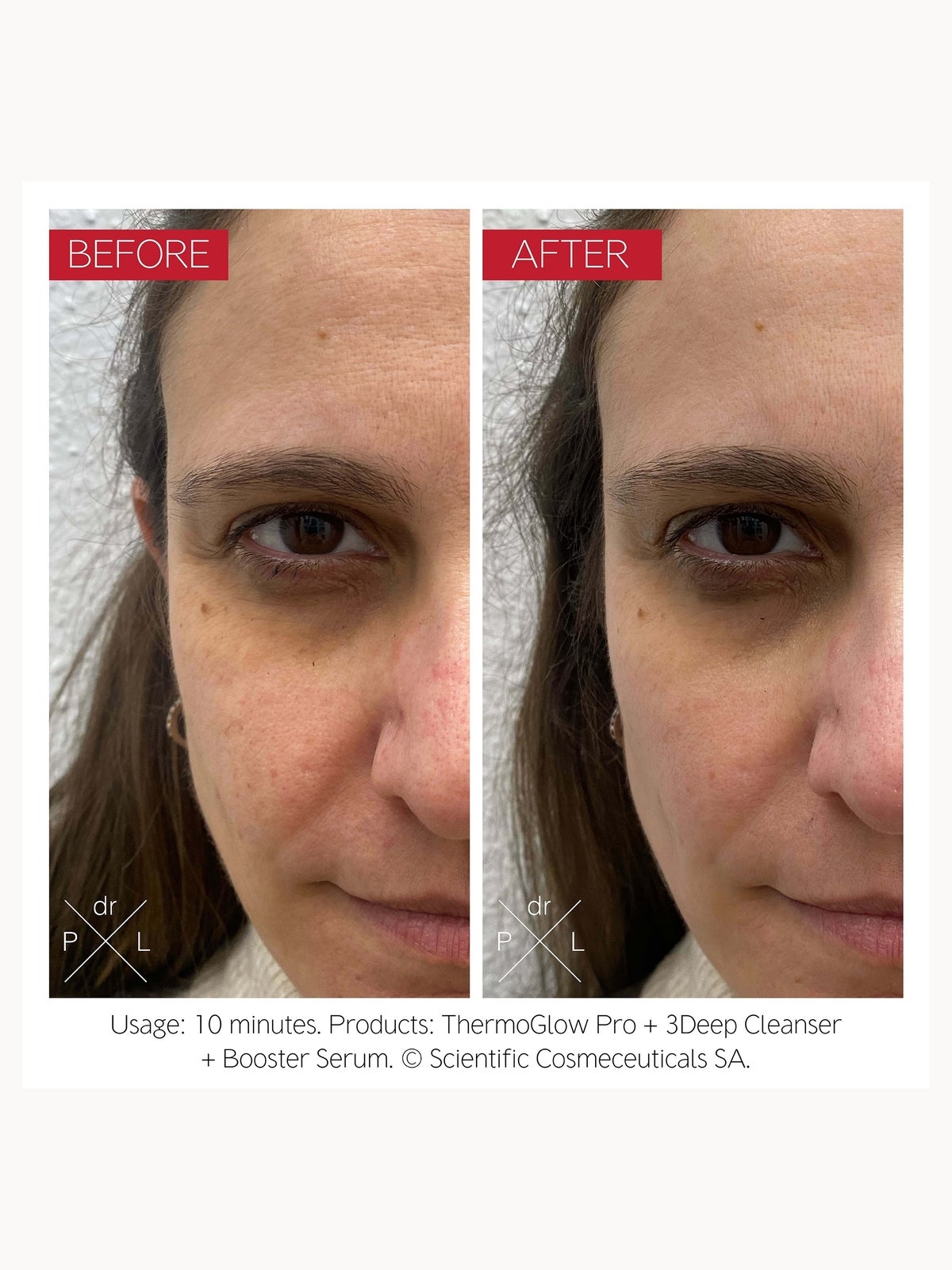 Dr. LEVY Switzerland The ThermoGlow Pro Device 4