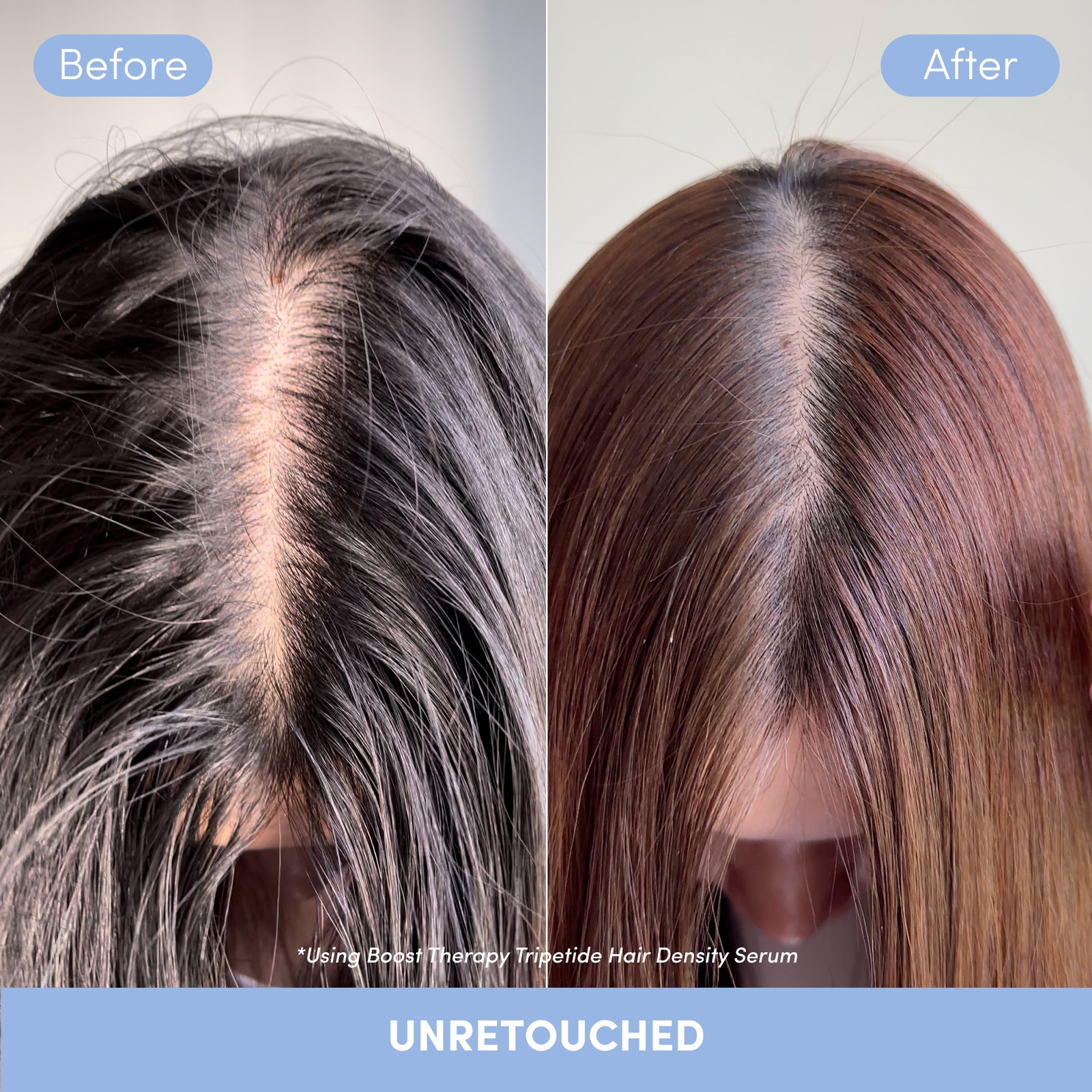 Thumbnail - Coco & Eve Boost Therapy Tripeptide Hair Density Serum 50ml