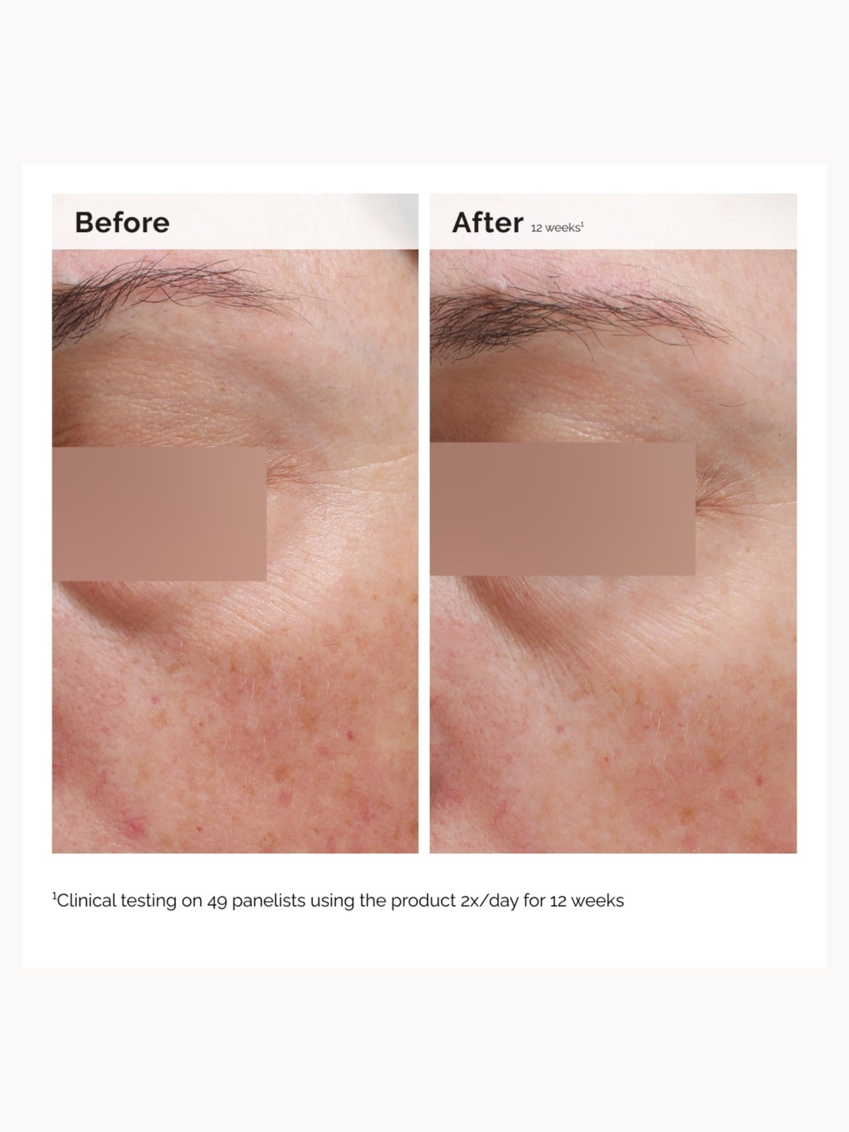 The Ordinary Niacinamide 5% Face and Body Emulsion 100ml 3