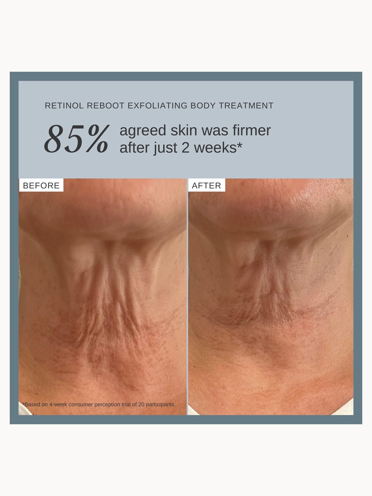 Alpha-H Retinol Reboot Exfoliating Body Treatment with 8% Glycolic Acid 2% Lactic Acid + 1% Encapsuladed Retinol 4