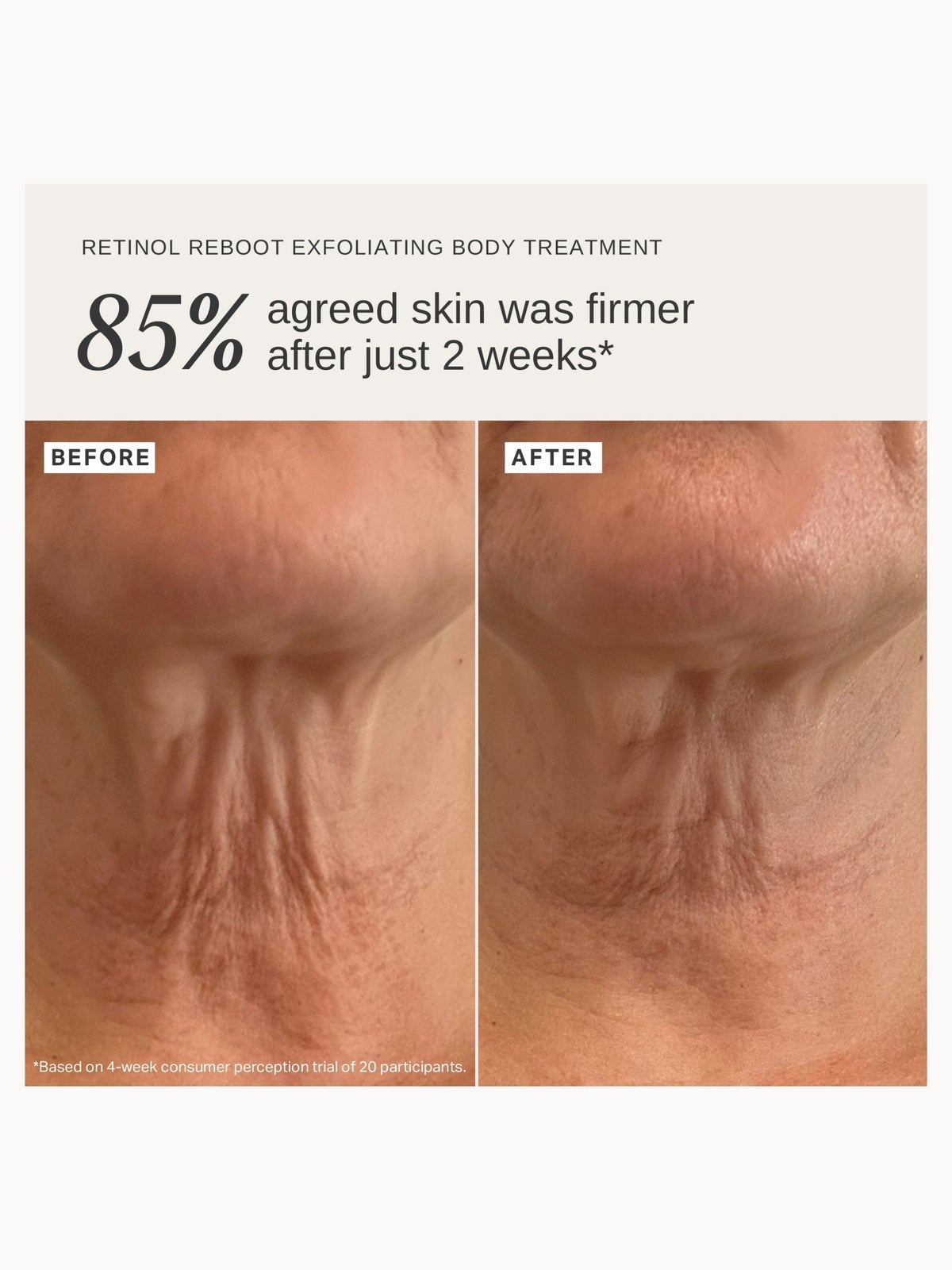 Alpha-H Retinol Reboot Exfoliating Body Treatment with 8% Glycolic Acid 2% Lactic Acid + 1% Encapsuladed Retinol 2