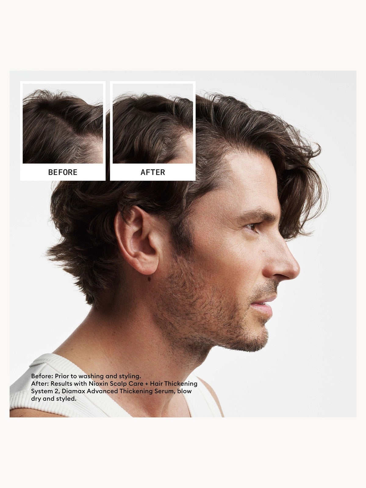 NIOXIN Scalp and Hair Thickening System 2 for Natural Hair with Progressed Thinning Loyalty Kit 4