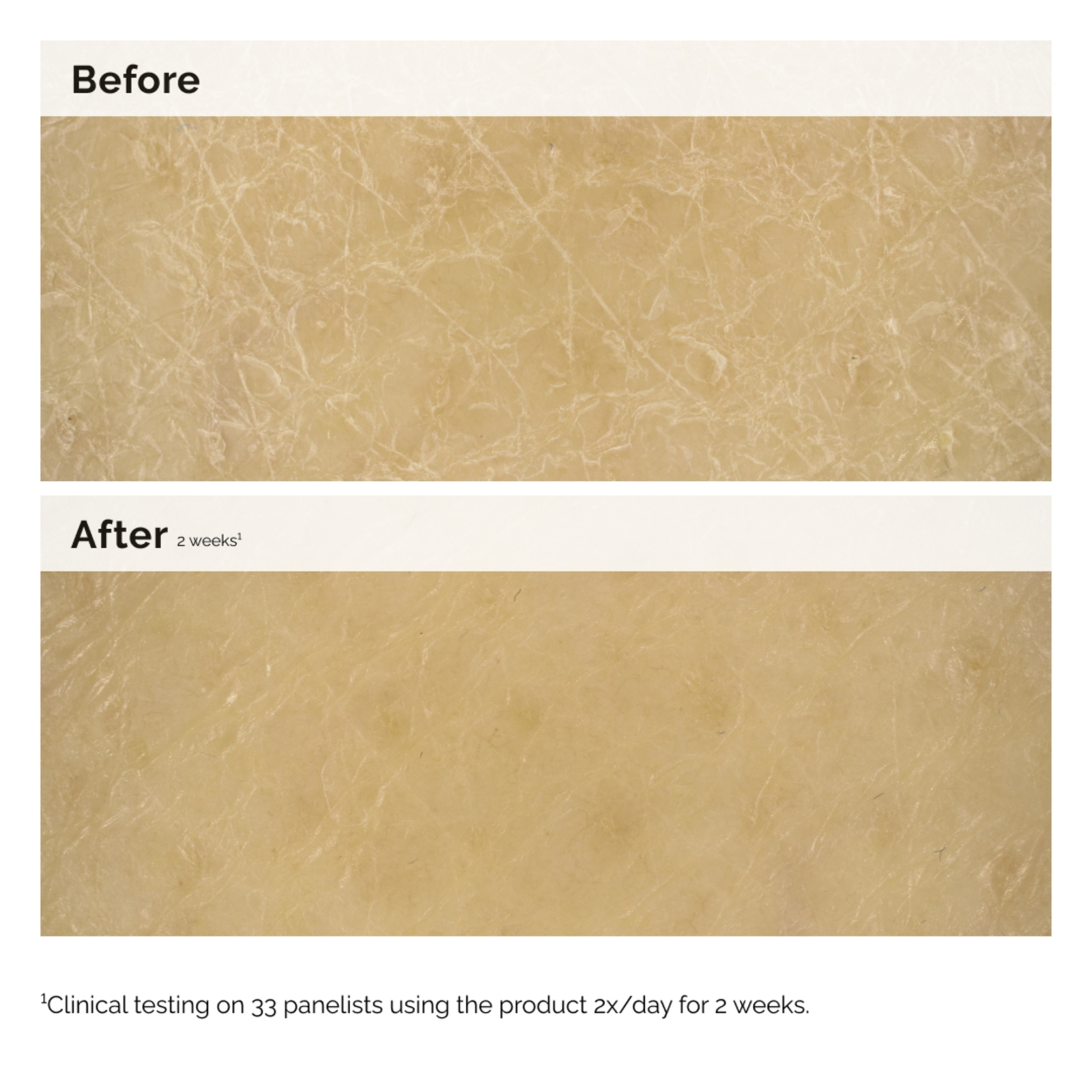 Thumbnail - The Ordinary Natural Moisturizing Factors + Inulin Body Lotion 240ml