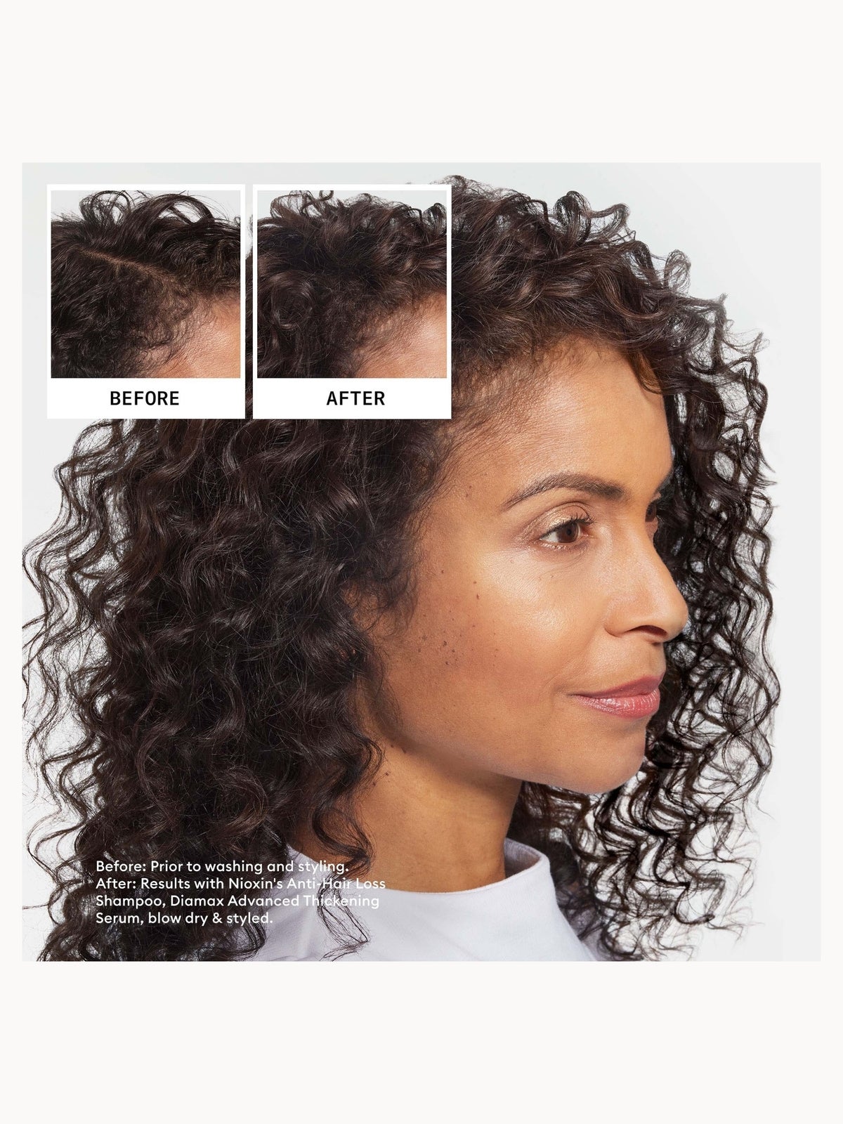 Nioxin Anti-Hair Loss Shampoo and Hair-Growth Serum Bundle 4