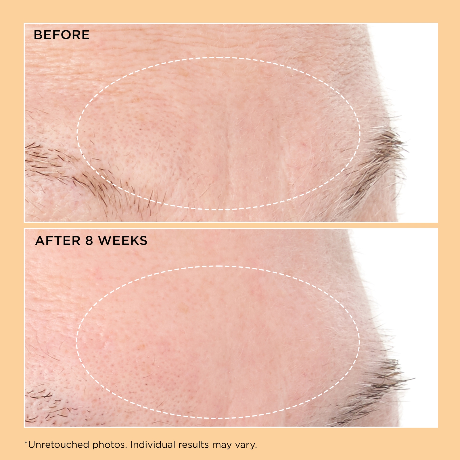 Thumbnail - Perricone MD Neuropeptide Deep Crease Serum 1oz FG