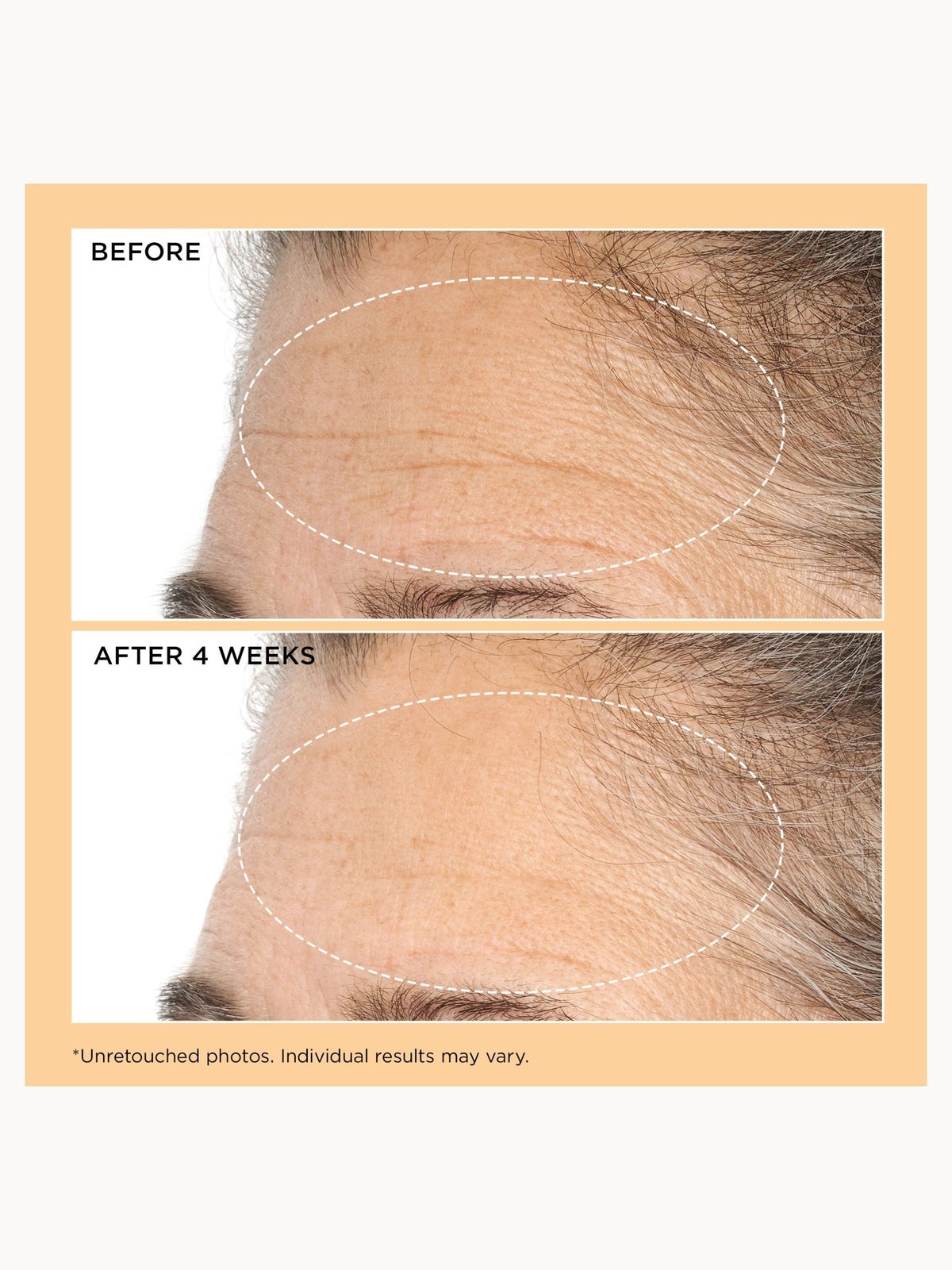 Perricone MD Neuropeptide Deep Crease Serum 3