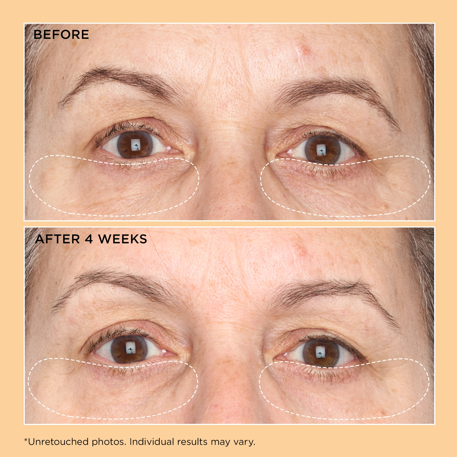 Thumbnail - Perricone MD Neuropeptide Eye Cream 15ml