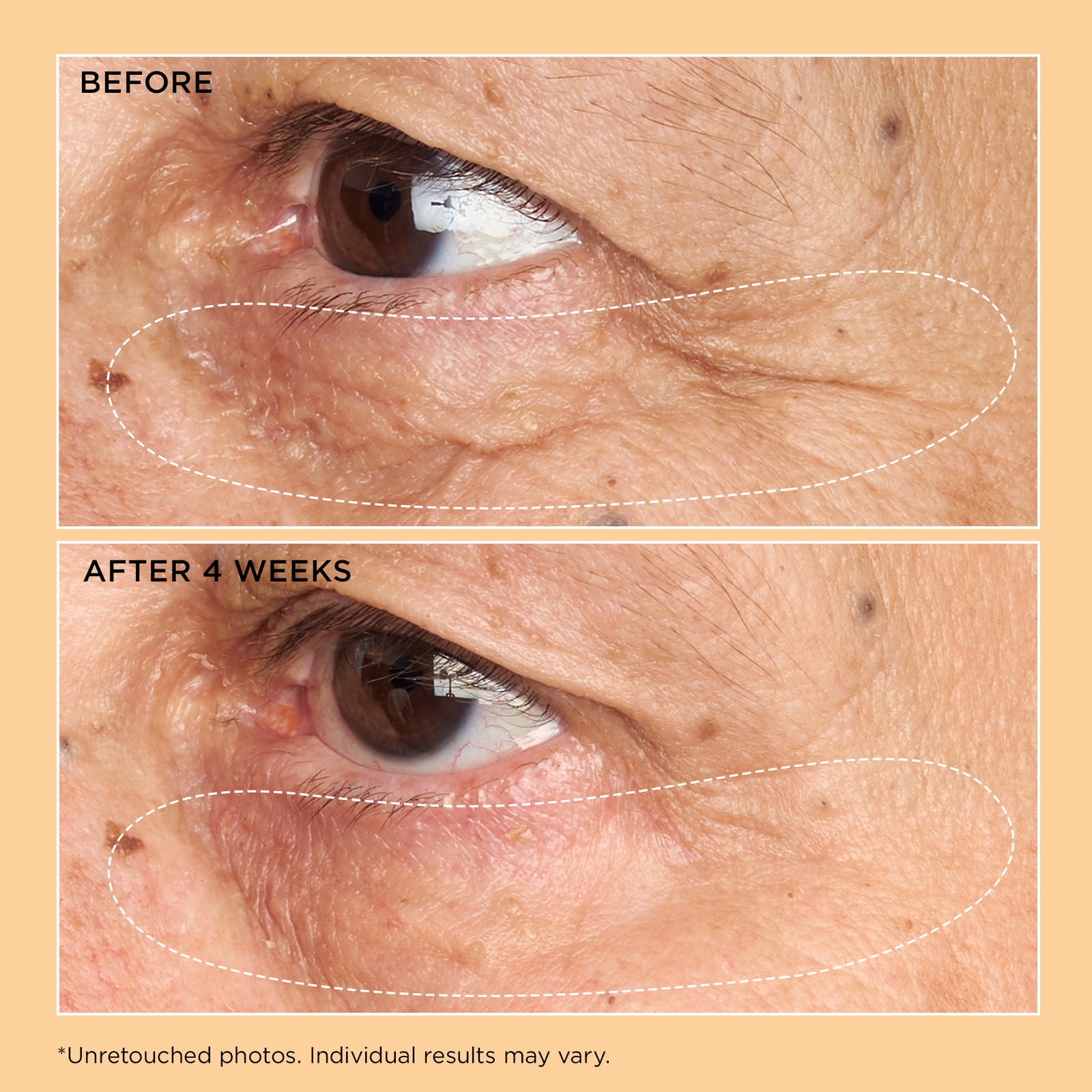 Thumbnail - Perricone MD Neuropeptide Eye Cream 15ml