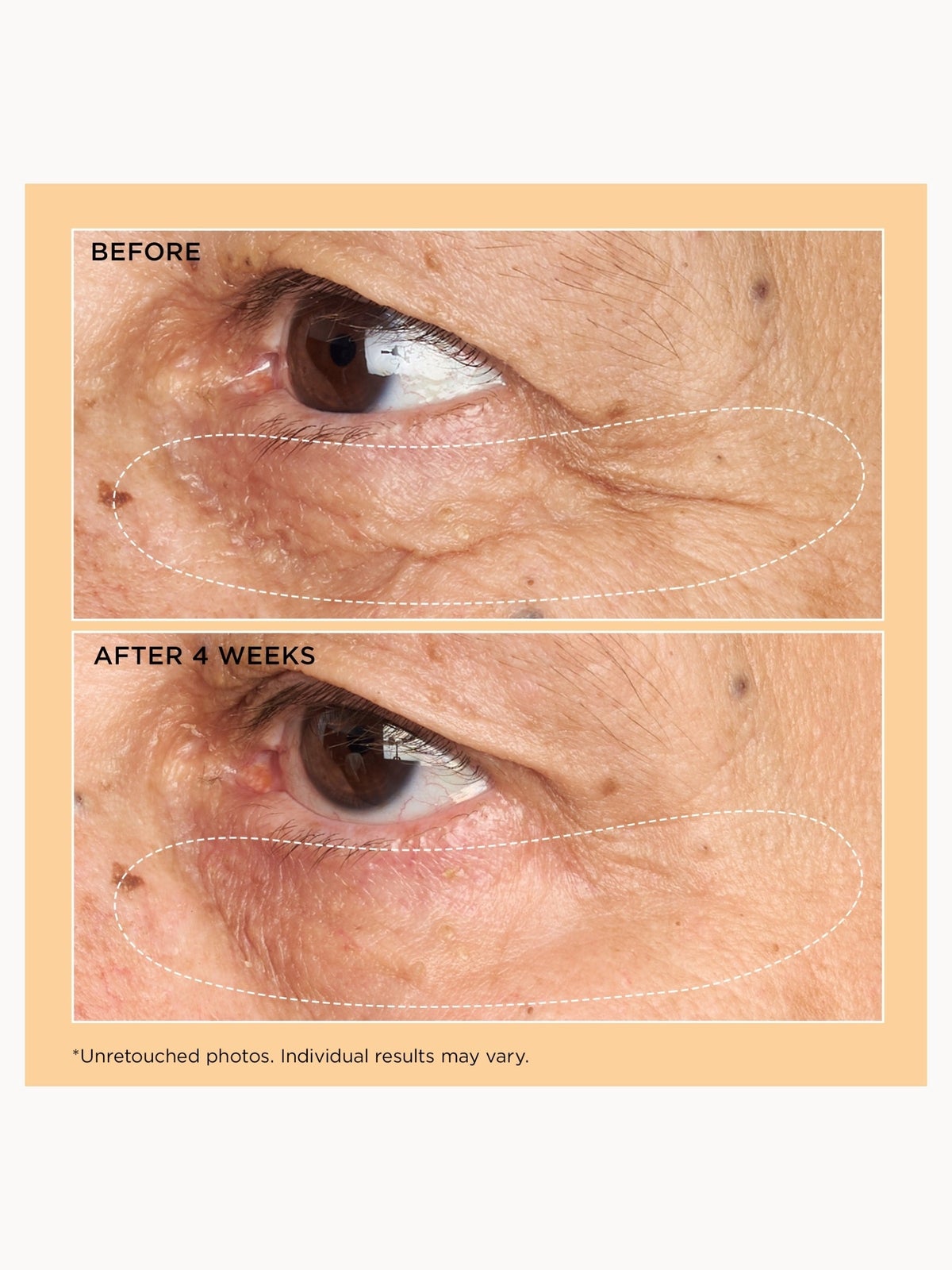 Perricone MD Neuropeptide Corrective Brightening Under-Eye Cream 3