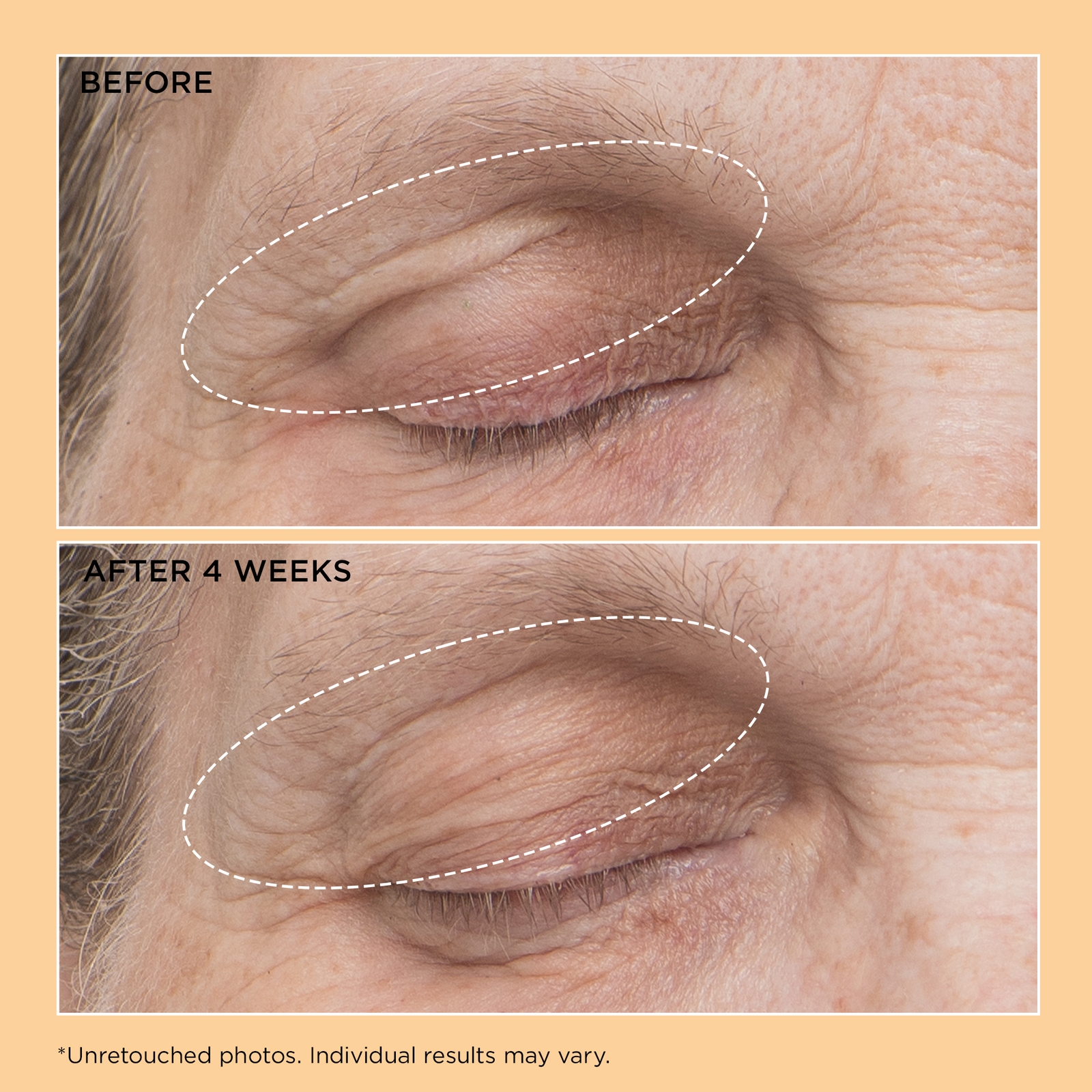 Thumbnail - Perricone MD Neuropeptide Eyelid Lift Serum 0.5oz FG