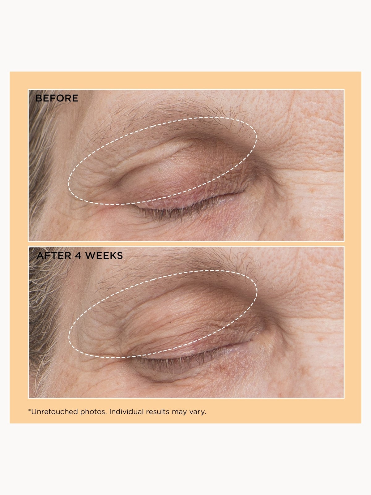 Perricone MD Neuropeptide Eyelid Lift Serum 3
