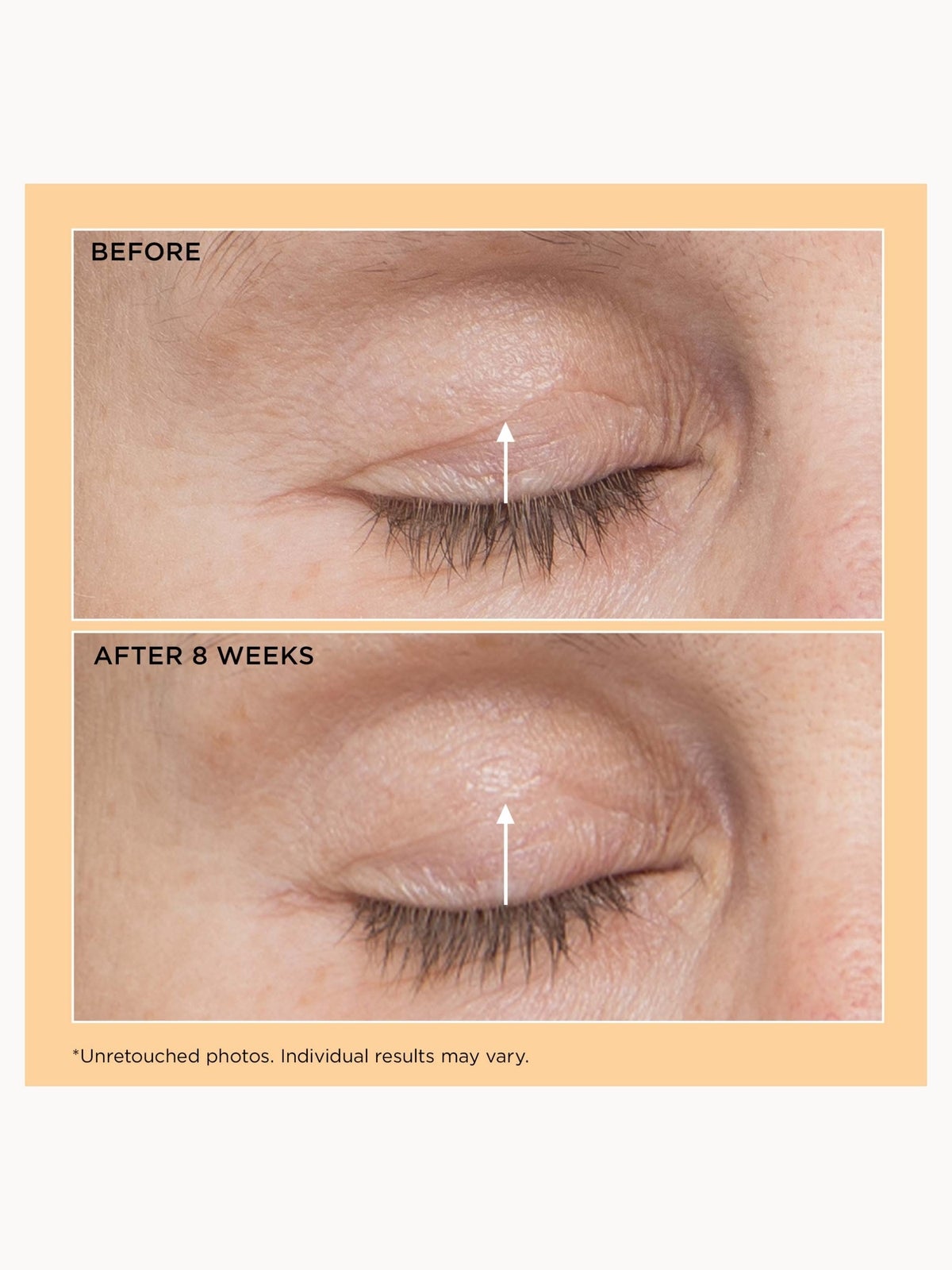 Perricone MD Neuropeptide Eyelid Lift Serum 4