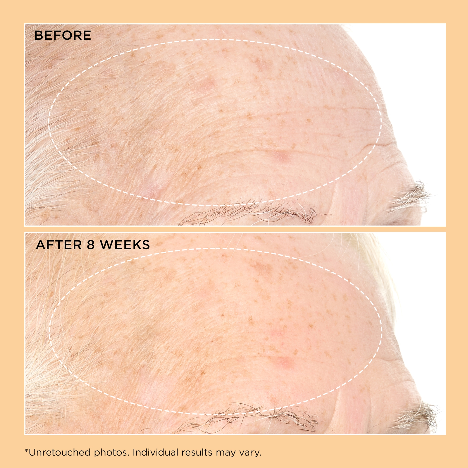 Thumbnail - Perricone MD Neuropeptide Moisturizer 59ml