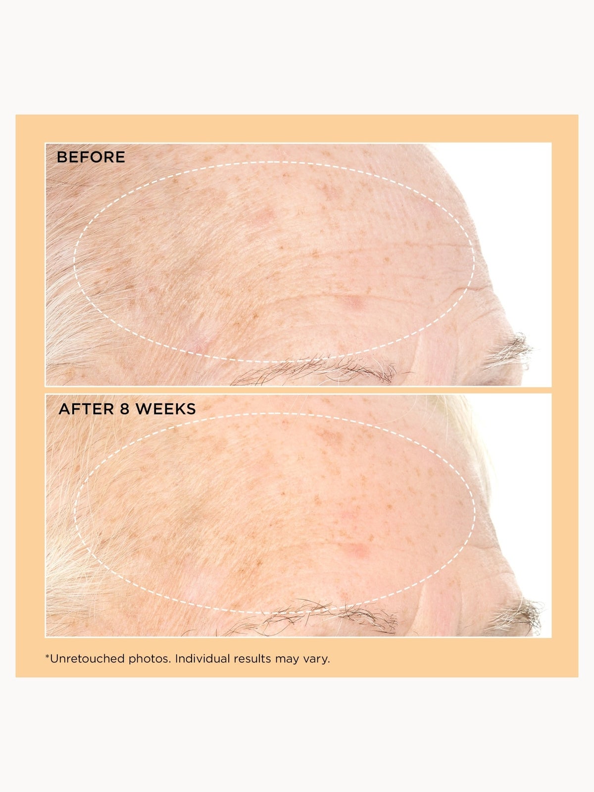 Perricone MD Neuropeptide Pro-Strength Firming Moisturiser 3