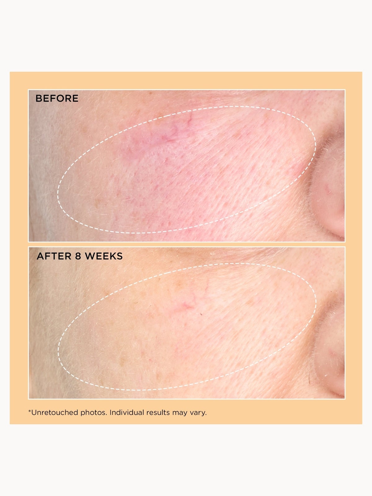 Perricone MD Neuropeptide Pro-Strength Firming Moisturiser 4