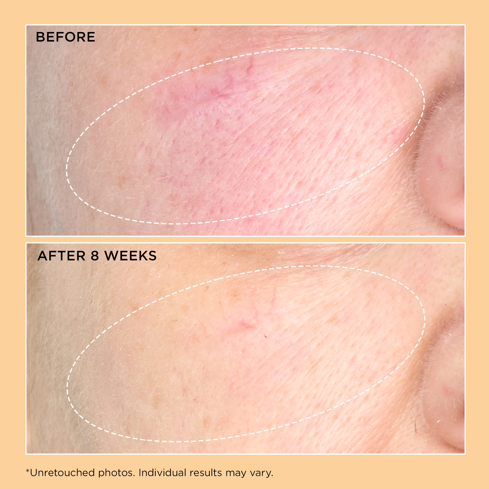 Thumbnail - Perricone MD Neuropeptide Moisturizer 59ml