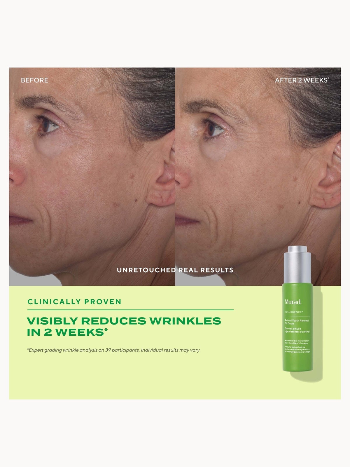 Murad Retinol Youth Renewal Oil Drops 30ml 4