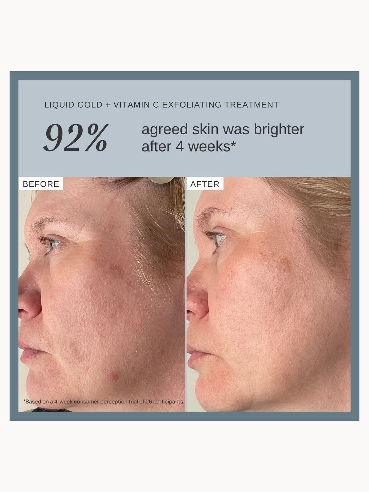 Alpha-H Liquid Gold Exfoliating Treatment with 5% Glycolic Acid and Vitamin C 100ml 4