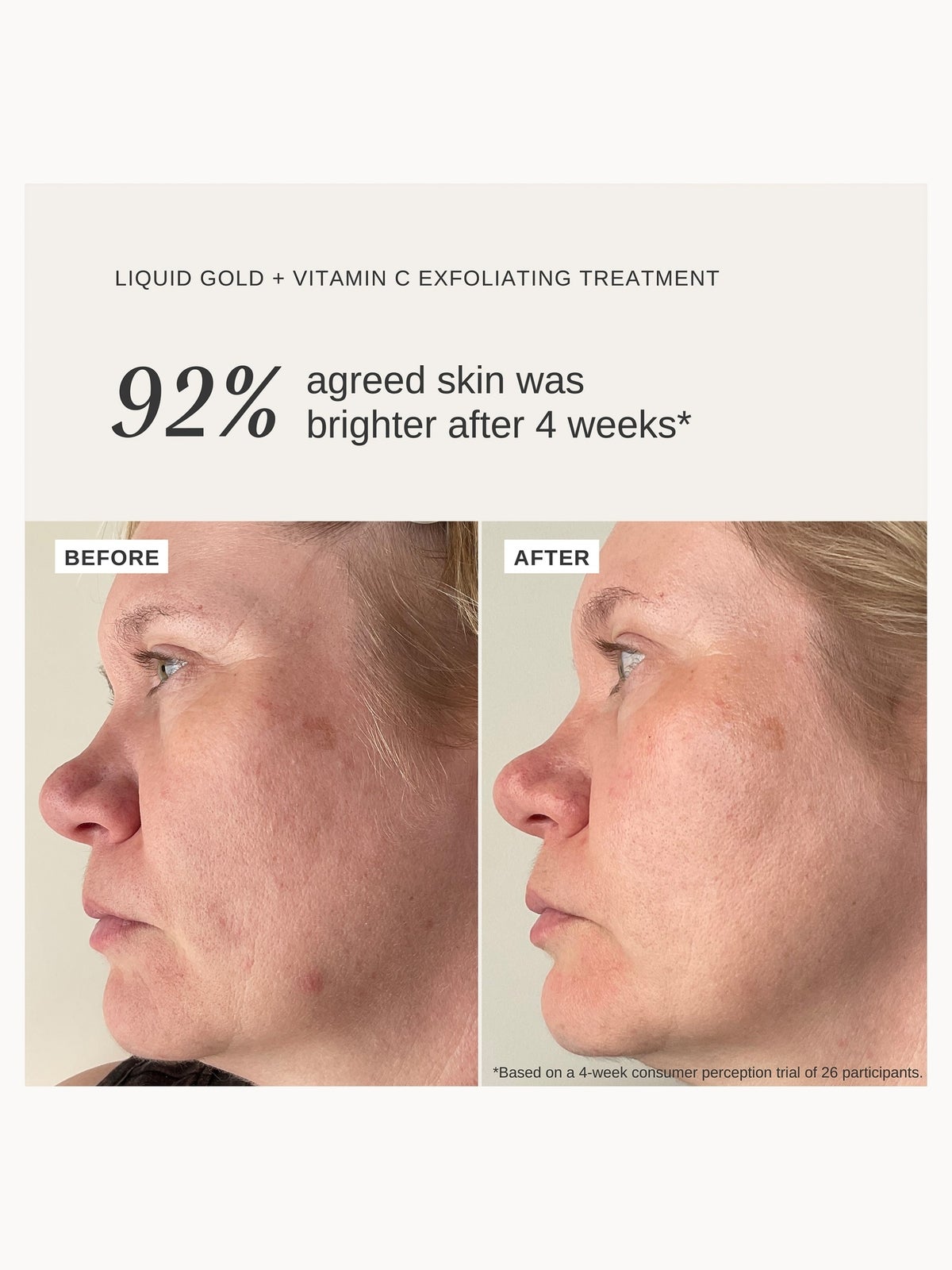 Alpha-H Liquid Gold Exfoliating Treatment with 5% Glycolic Acid and Vitamin C 100ml 2