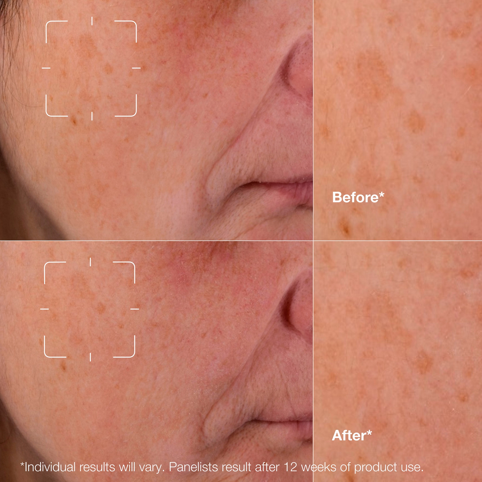 Thumbnail - Clinique Even Better Clinical Dark Spot Clearing Serum 75ml