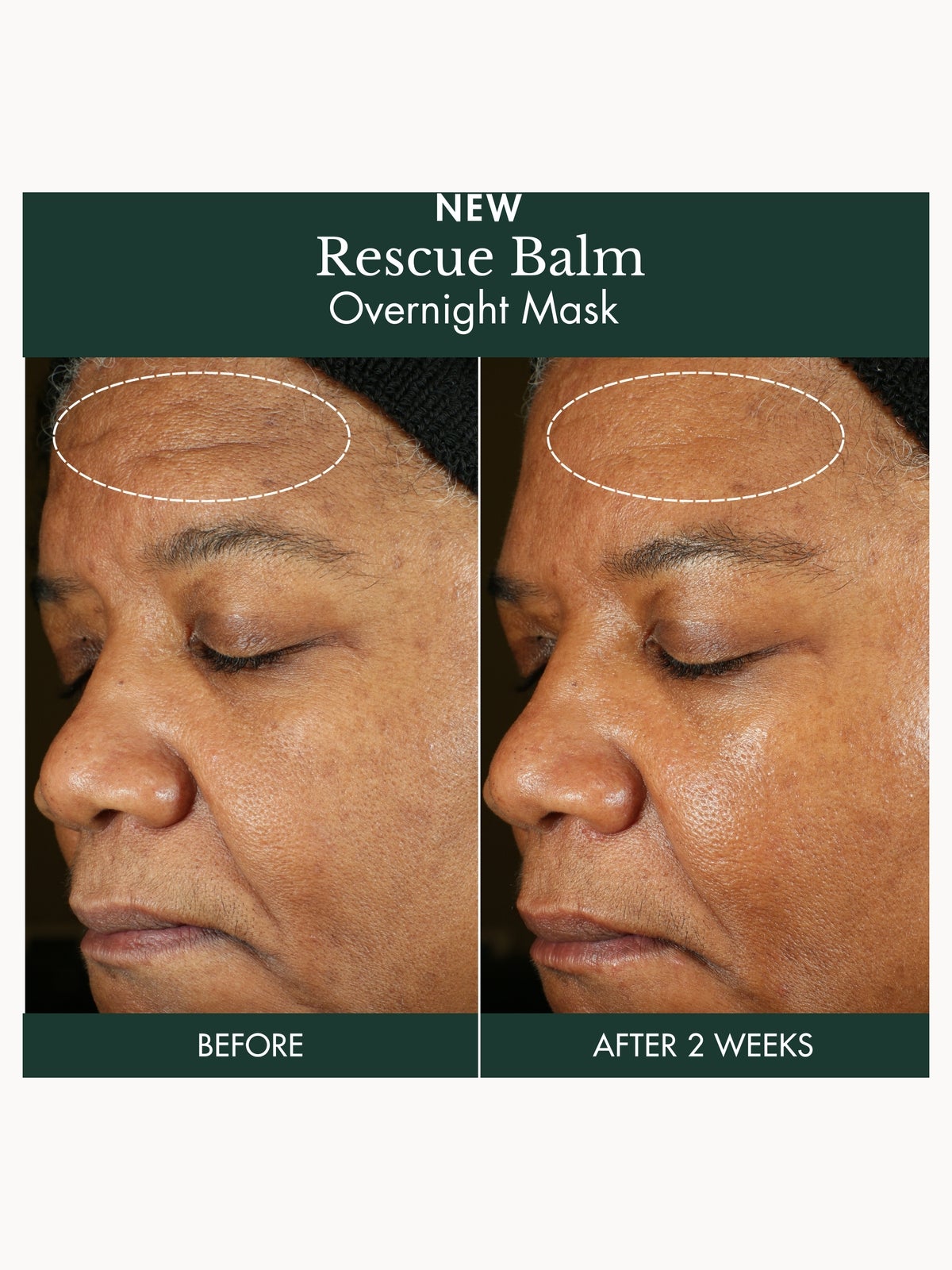 RéVive Rescue Balm Overnight Mask 75ml 3